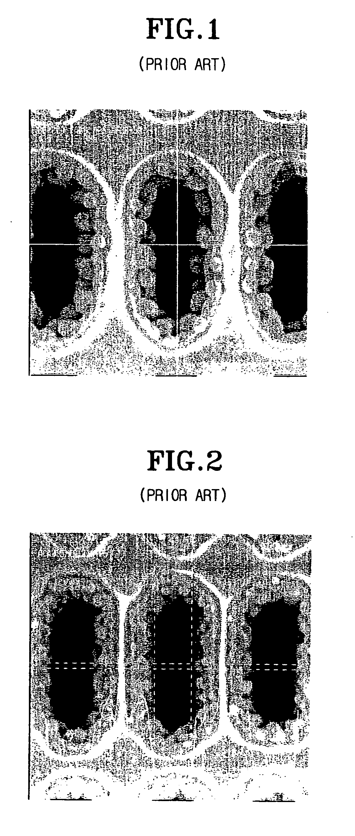 Method for forming capacitor of semiconductor device