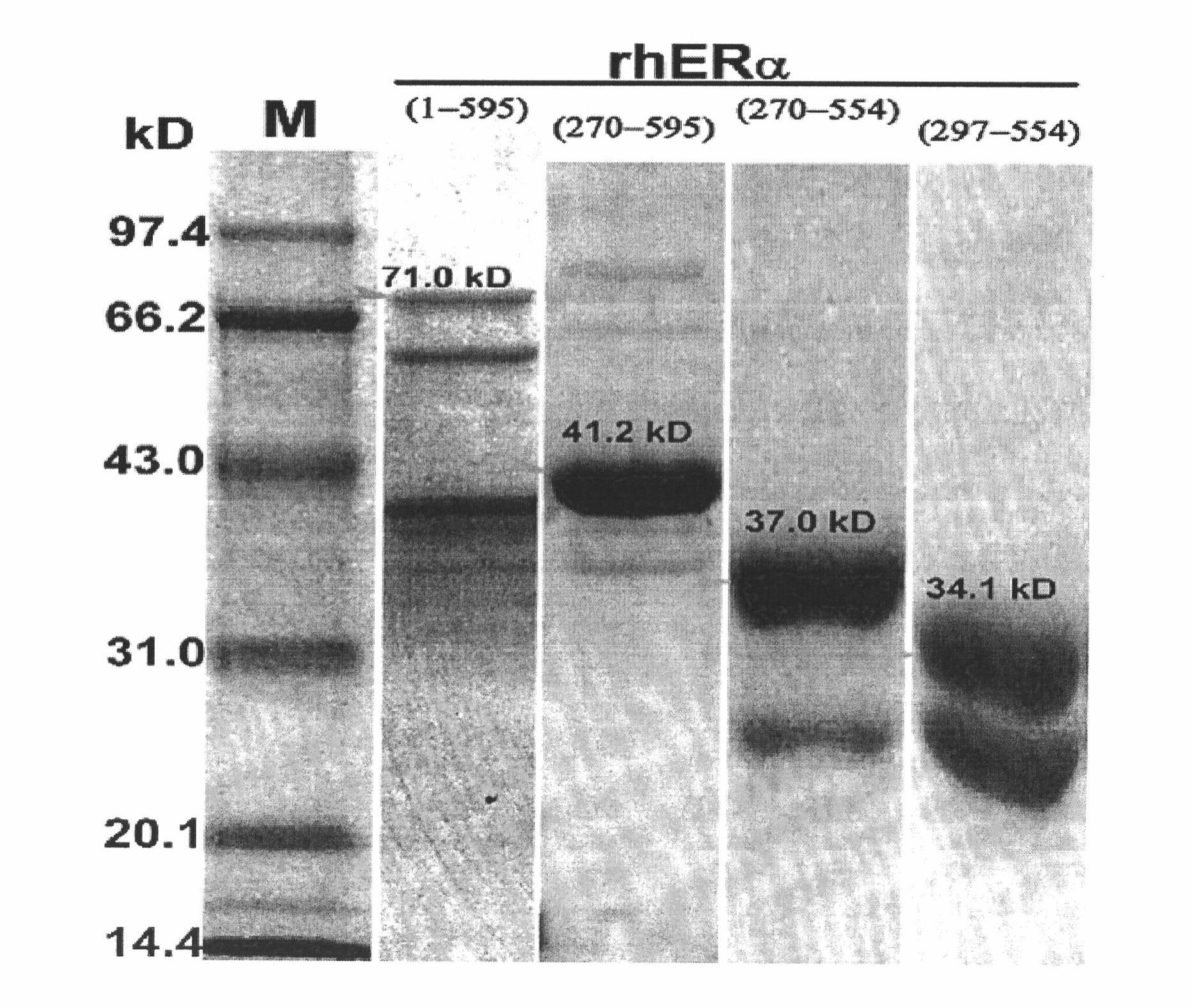 Recombined human estrogen Alpha receptor ligand binding domain protein as well as preparation and application thereof