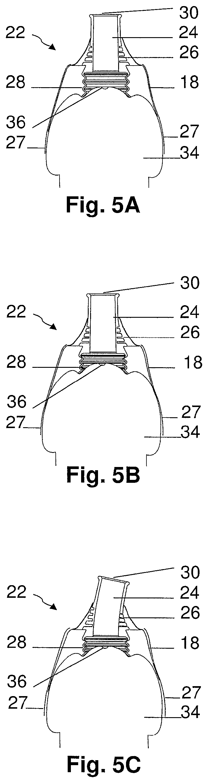 Device and method for external urinary incontinence treatment for men