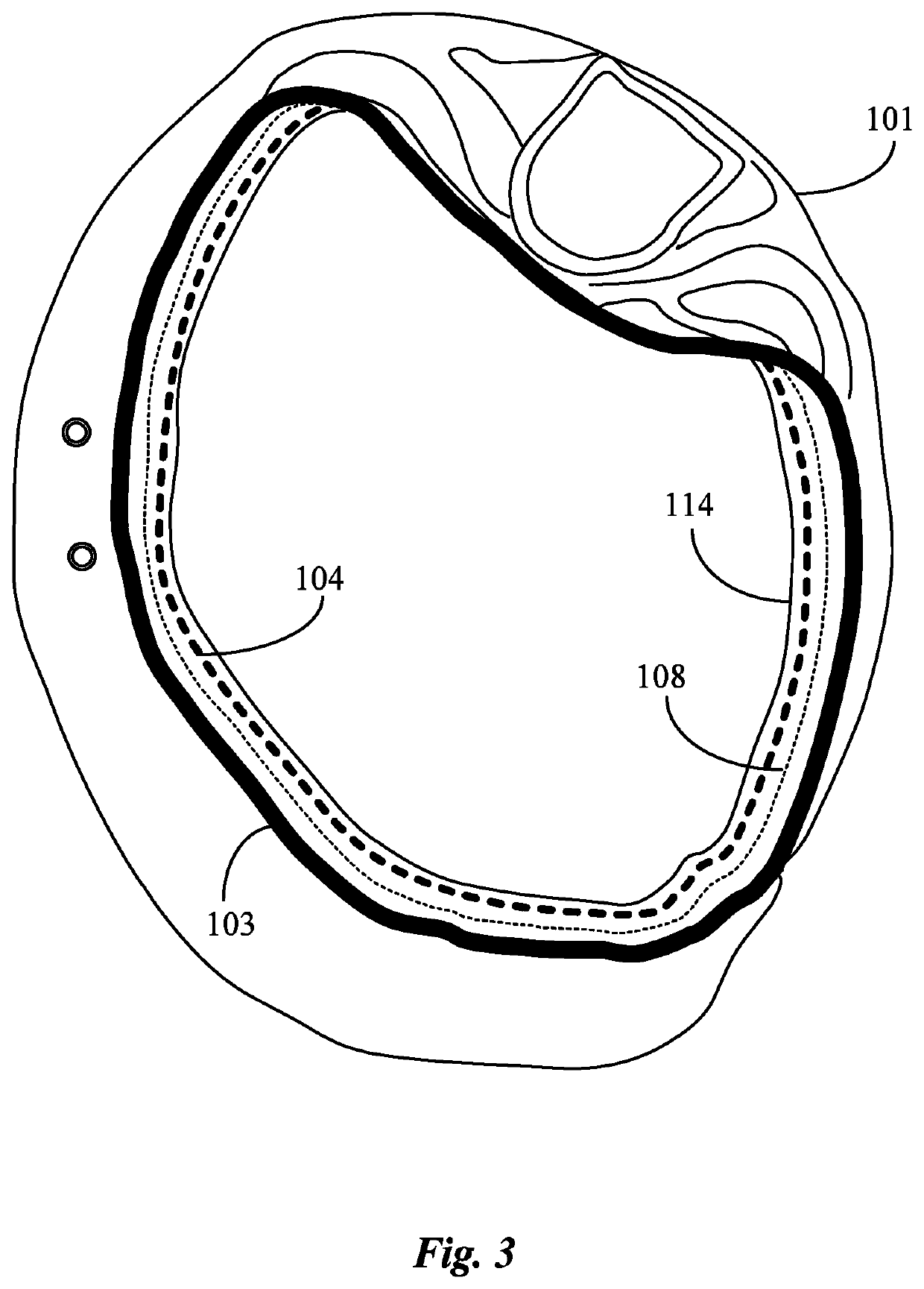 Head Covering With Removable Liner