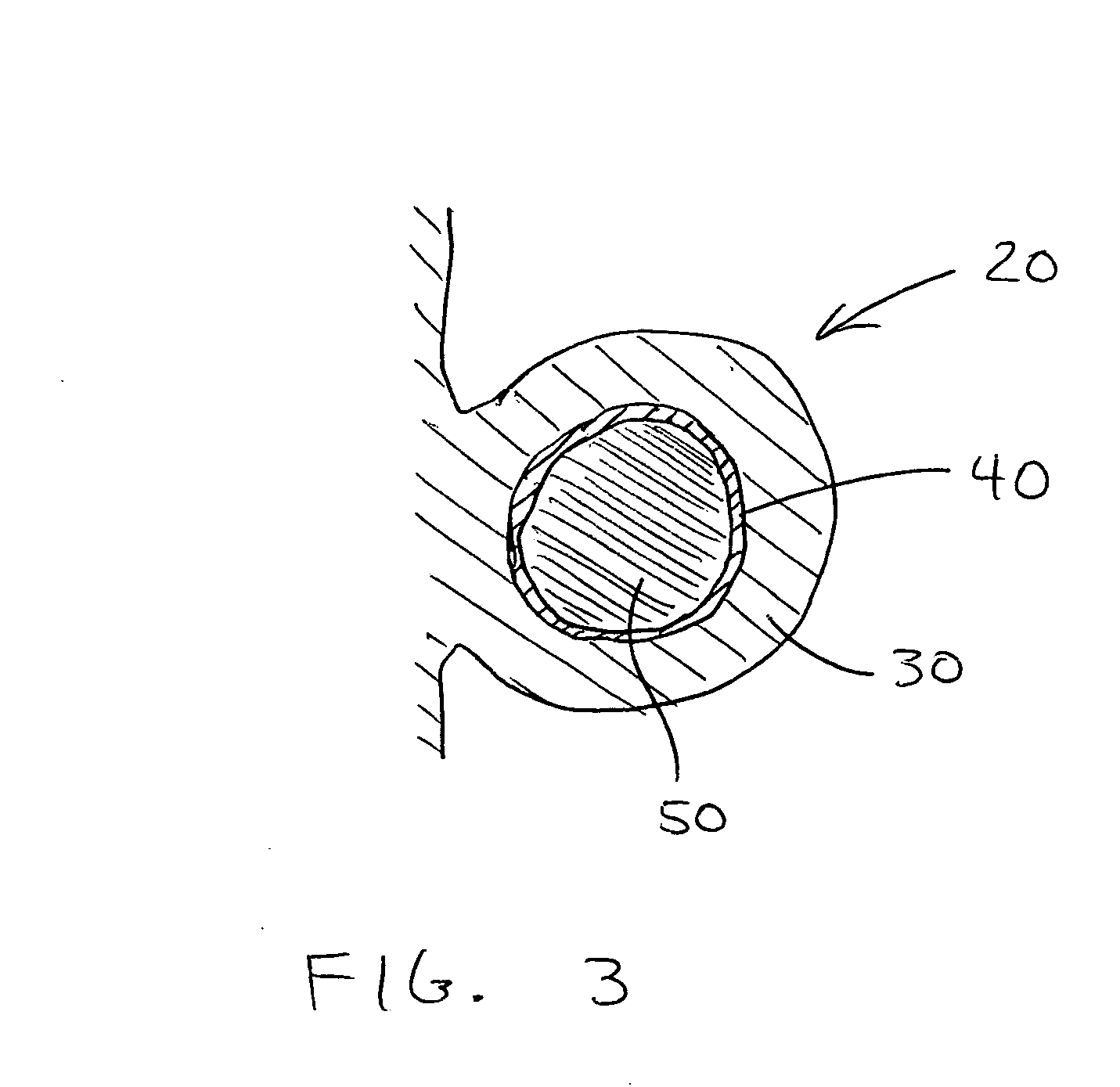 Prosthetic heart valves