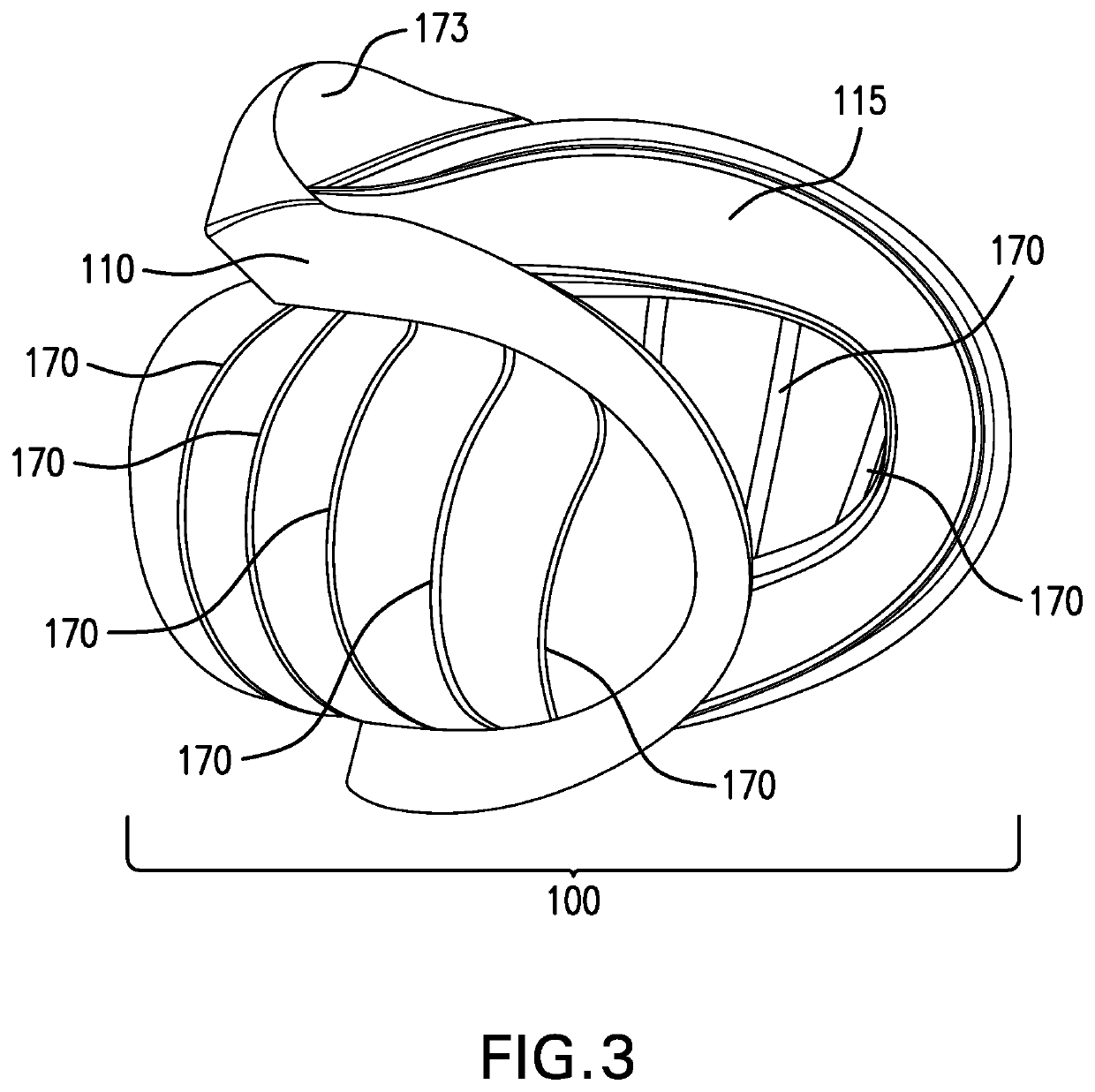 Device and method for opening an airway