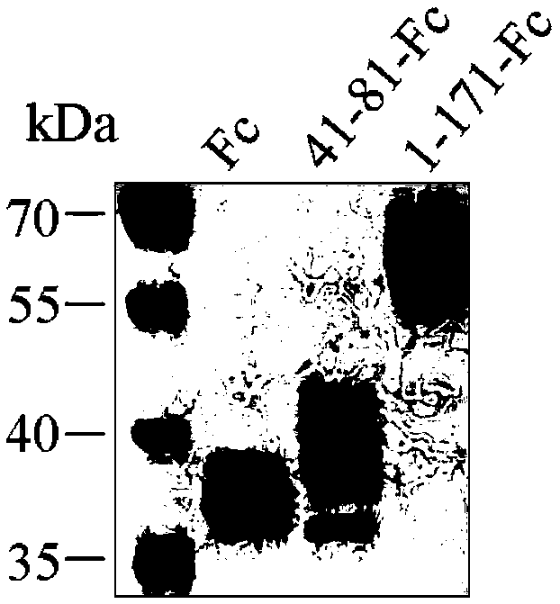 Application of polypeptide for preparing medicine for treating Alzheimer disease