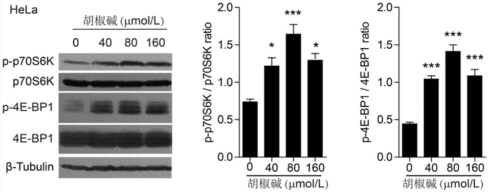 Application of piperine in the preparation of drugs for preventing and treating sepsis