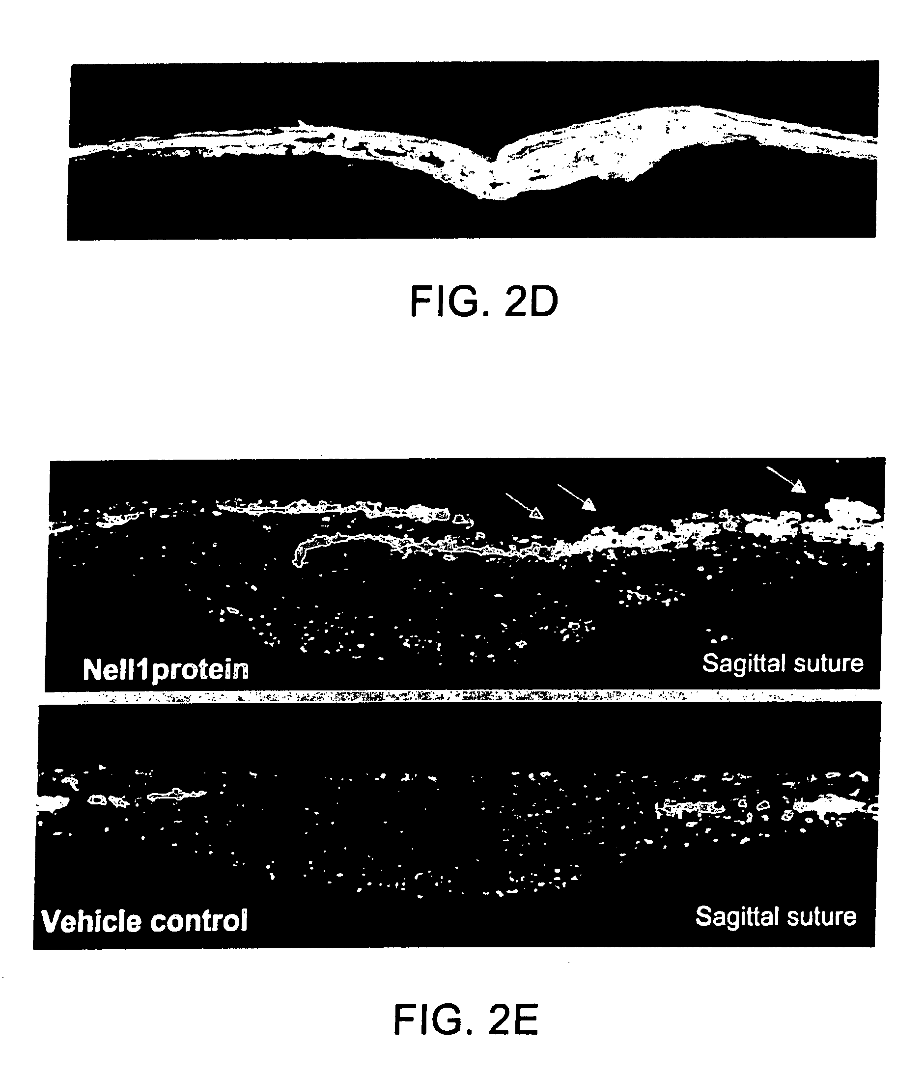 Pharmaceutical compositions for treating or preventing bone conditions