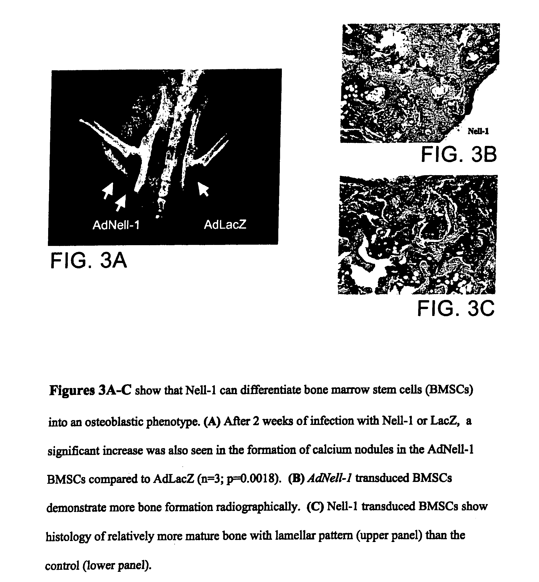 Pharmaceutical compositions for treating or preventing bone conditions