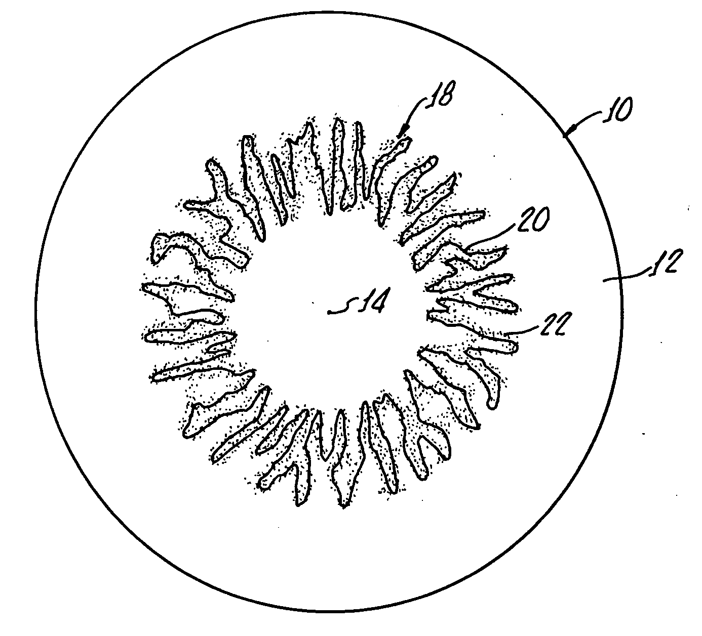 Iris design as a drug depot for zonal drug delivery by contact lens