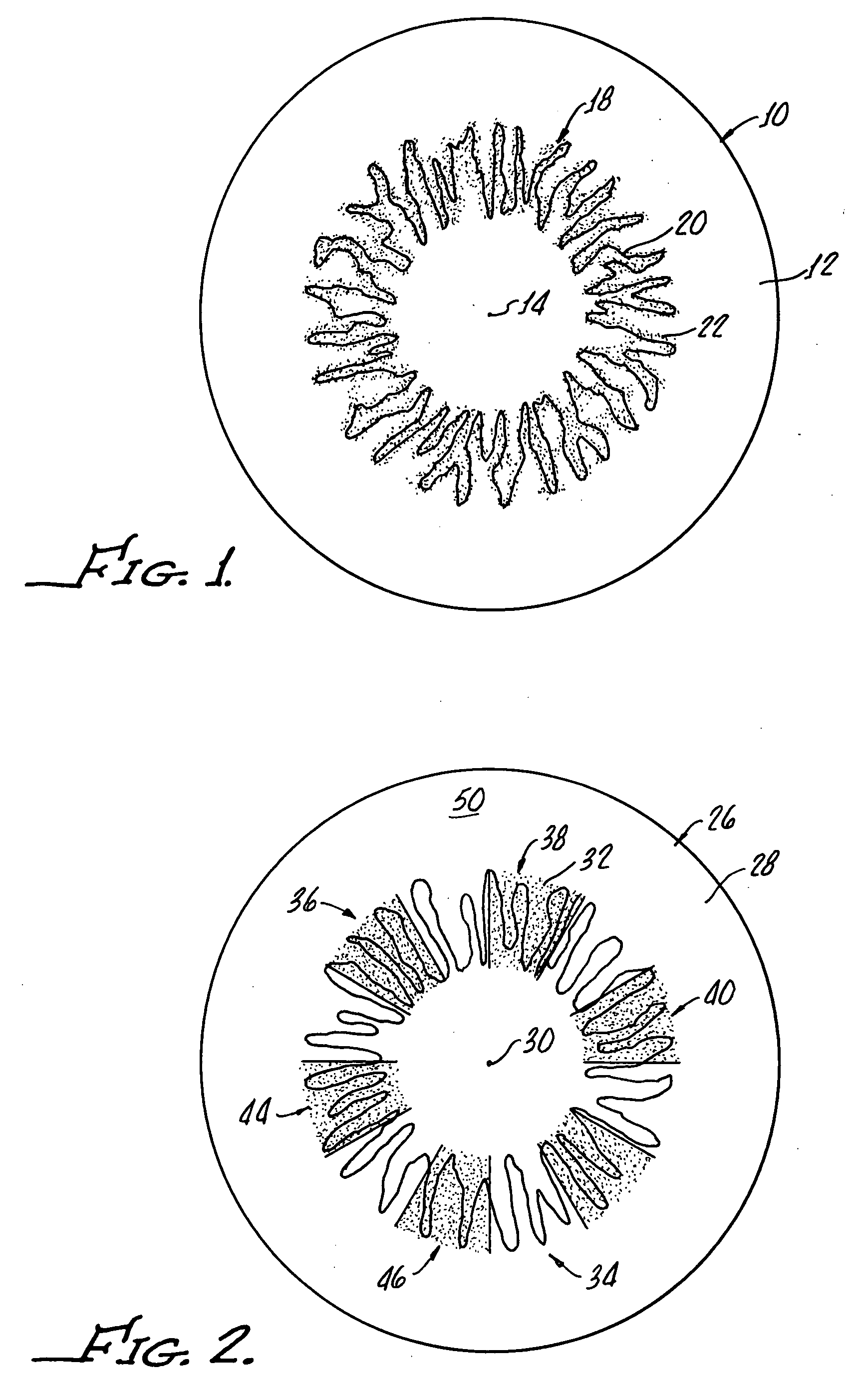 Iris design as a drug depot for zonal drug delivery by contact lens