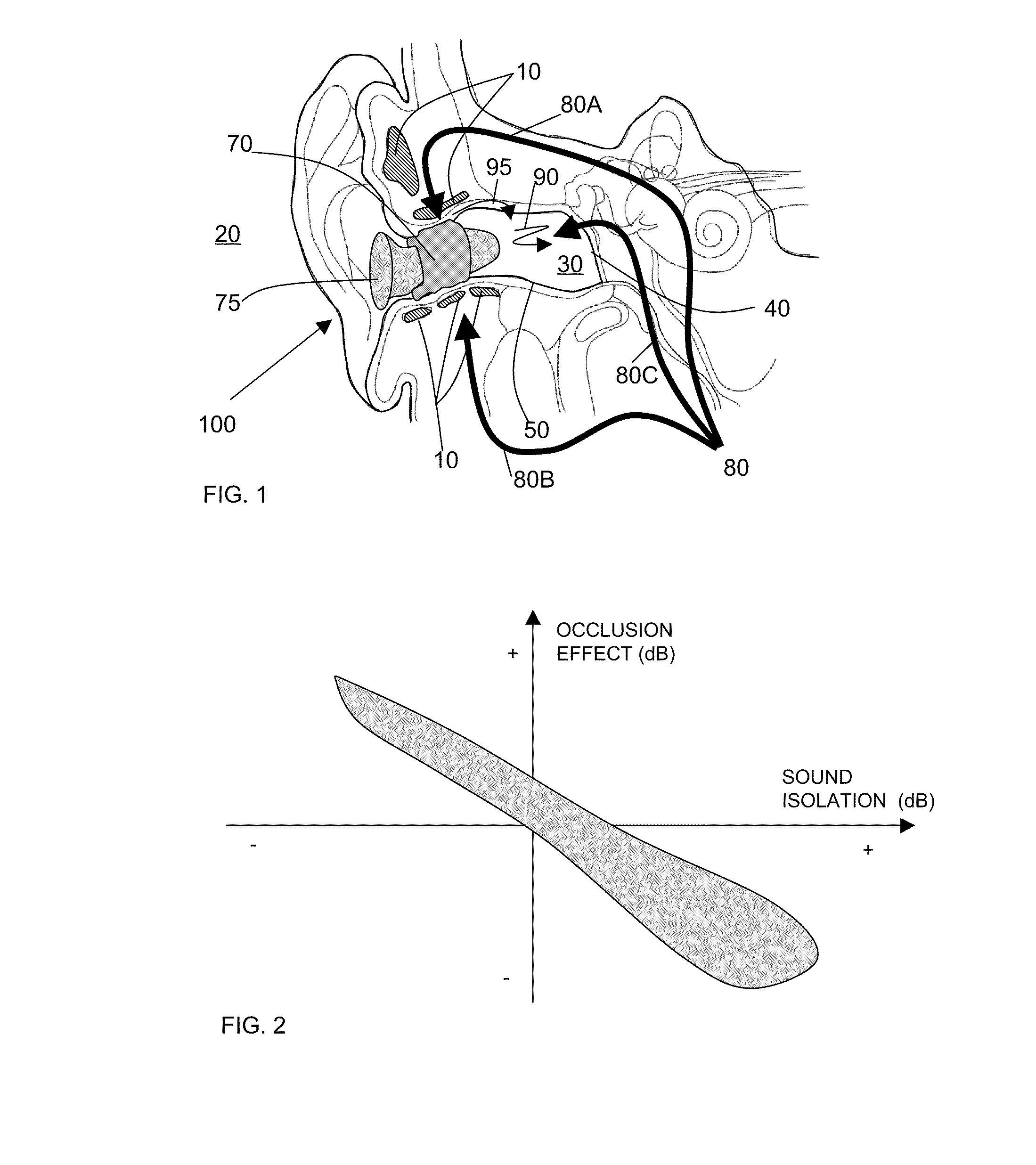 Occlusion effect mitigation and sound isolation device for orifice inserted systems