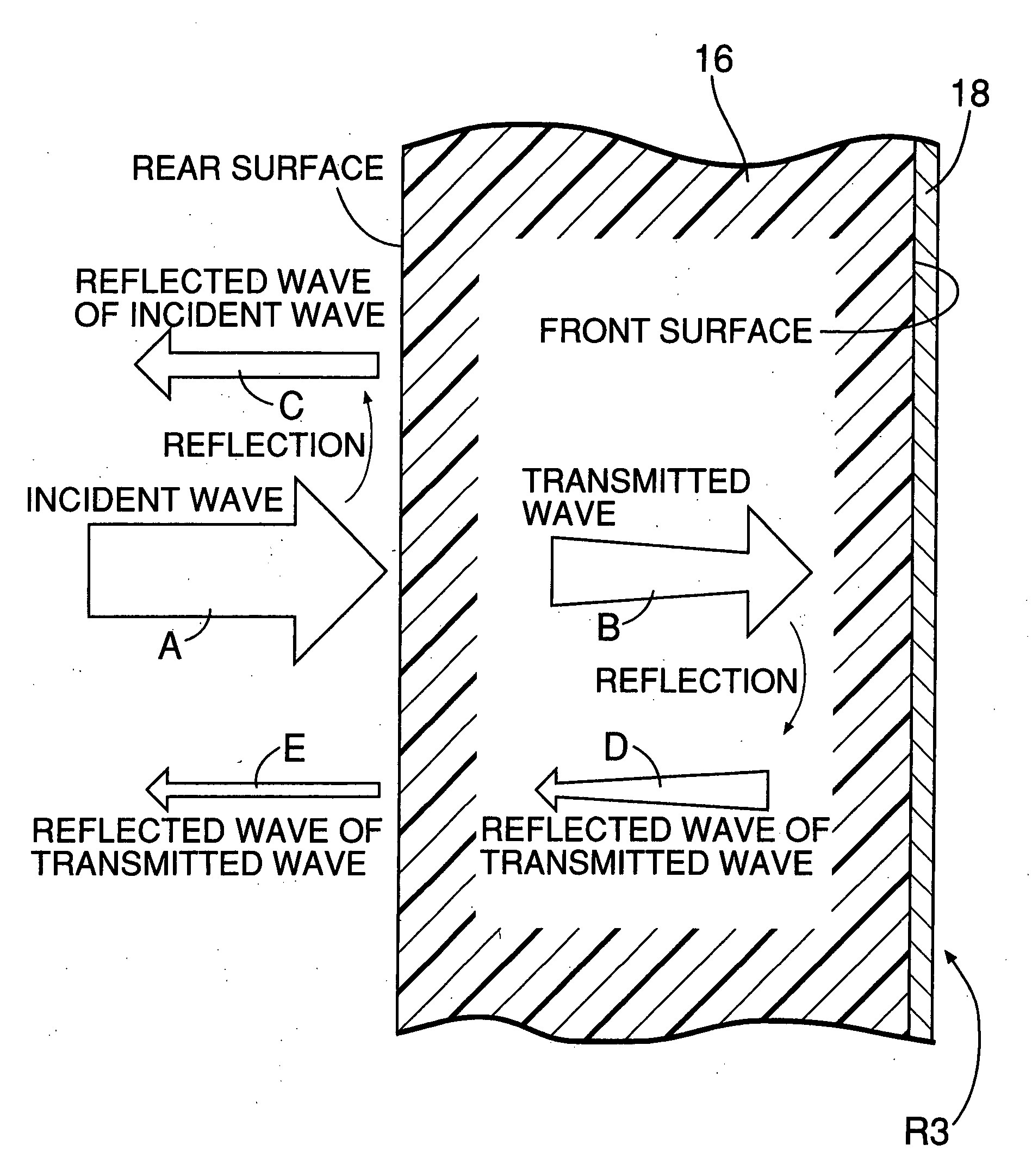 Exterior component disposed on front surface of radar device of vehicle