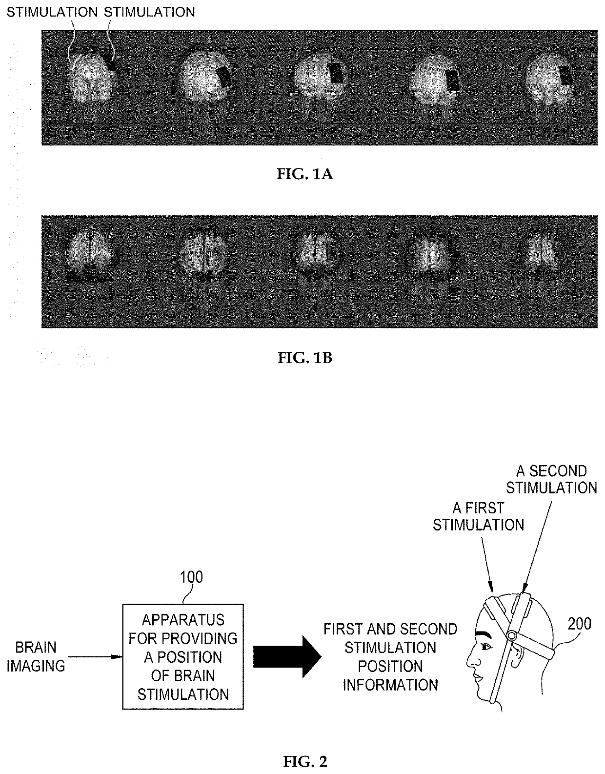 Apparatus and method for providing position of brain stimulation