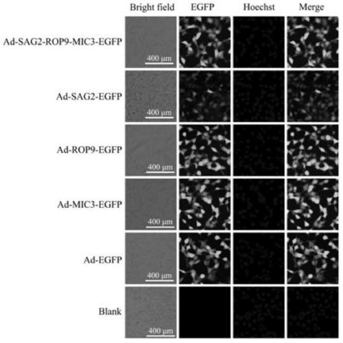 Construction method of SAG2 gene, ROP9 gene and MIC3 gene recombinant adenovirus, recombinant adenovirus and application