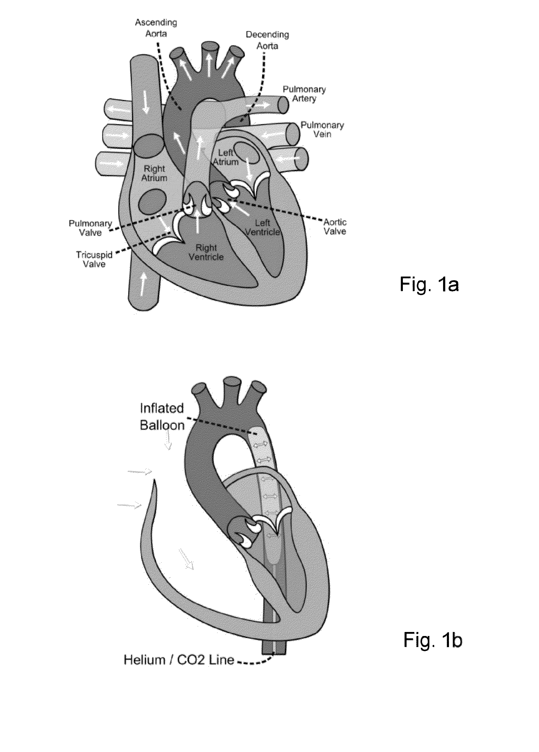 Electroactive actuators