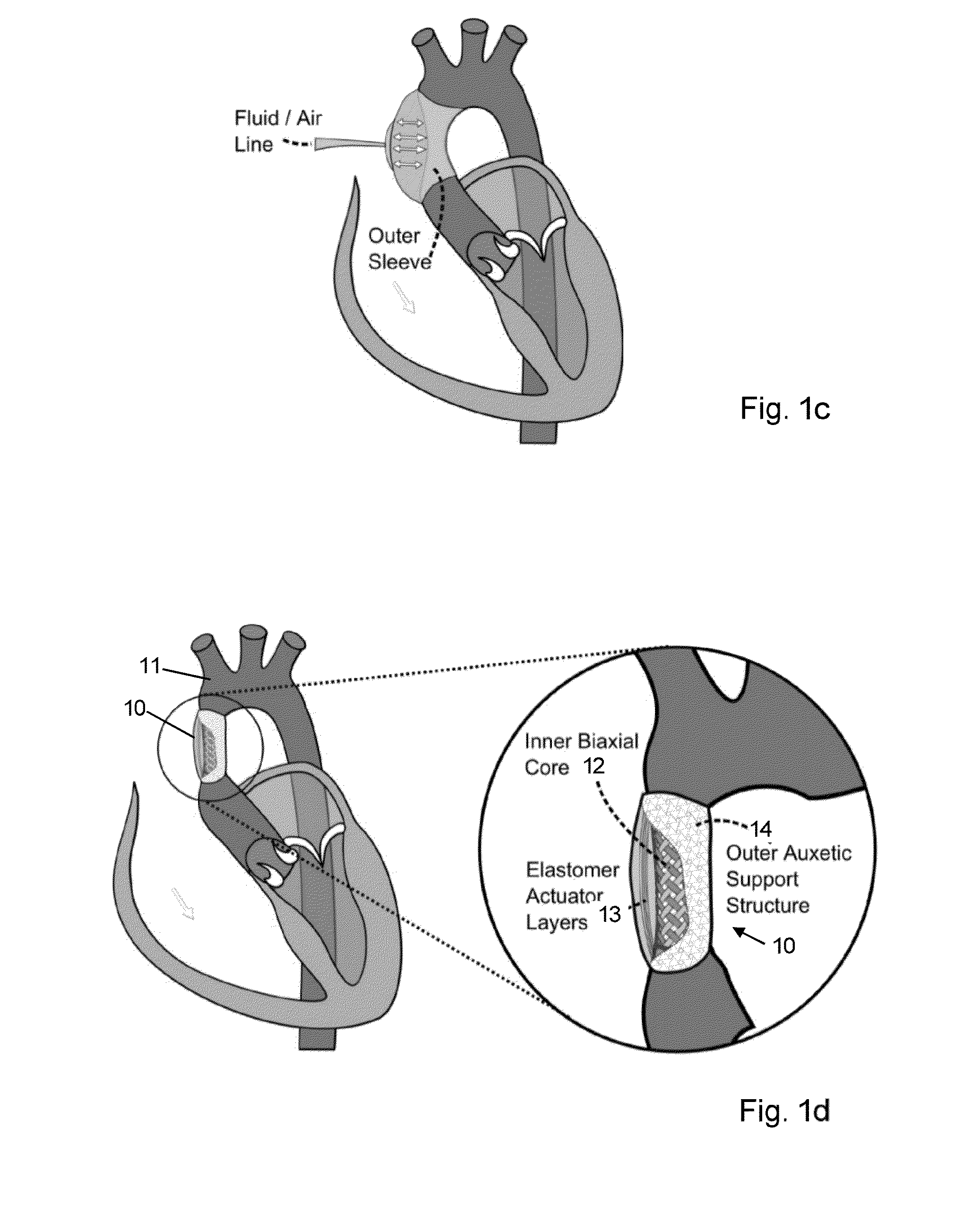 Electroactive actuators