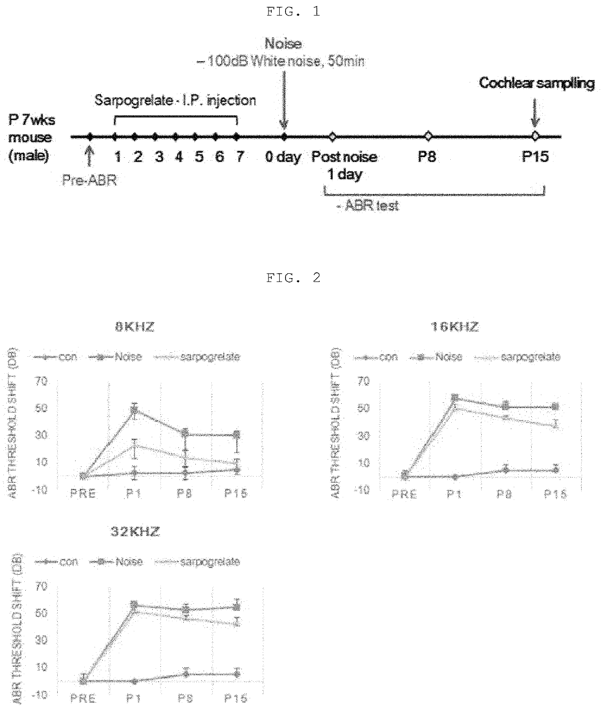 Composition, containing sarpogrelate as active ingredient, for preventing or treating sensorineural hearing loss