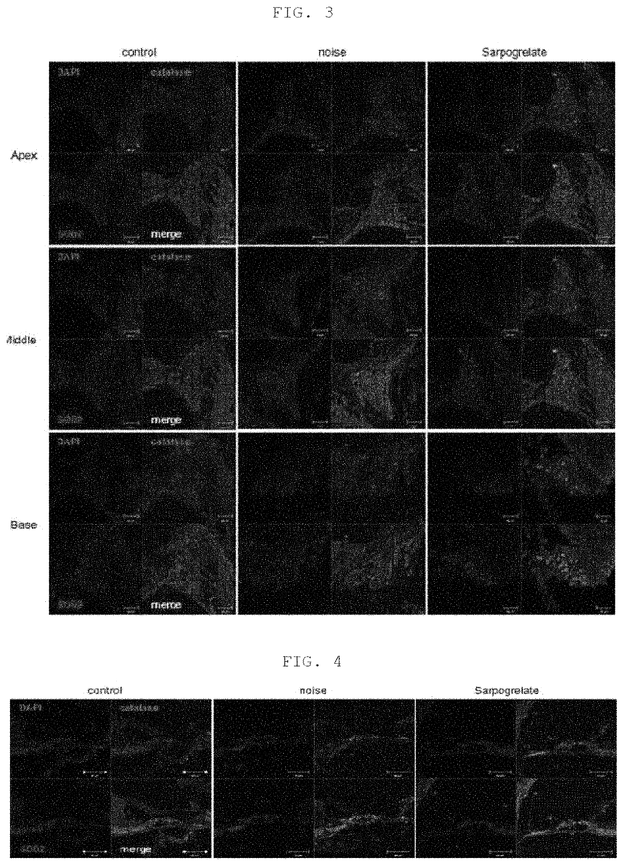 Composition, containing sarpogrelate as active ingredient, for preventing or treating sensorineural hearing loss