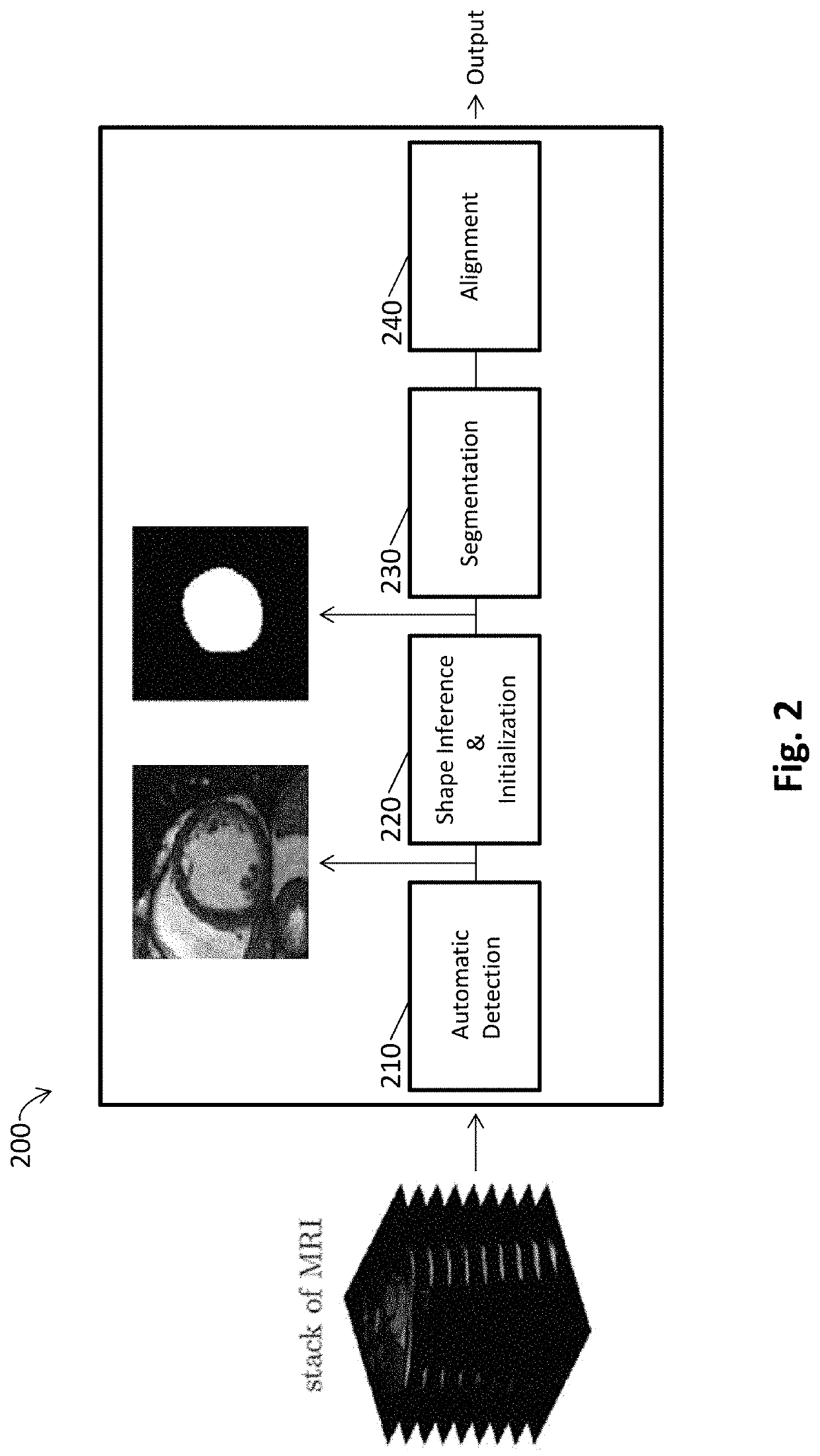 Automated segmentation of organ chambers using deep learning methods from medical imaging