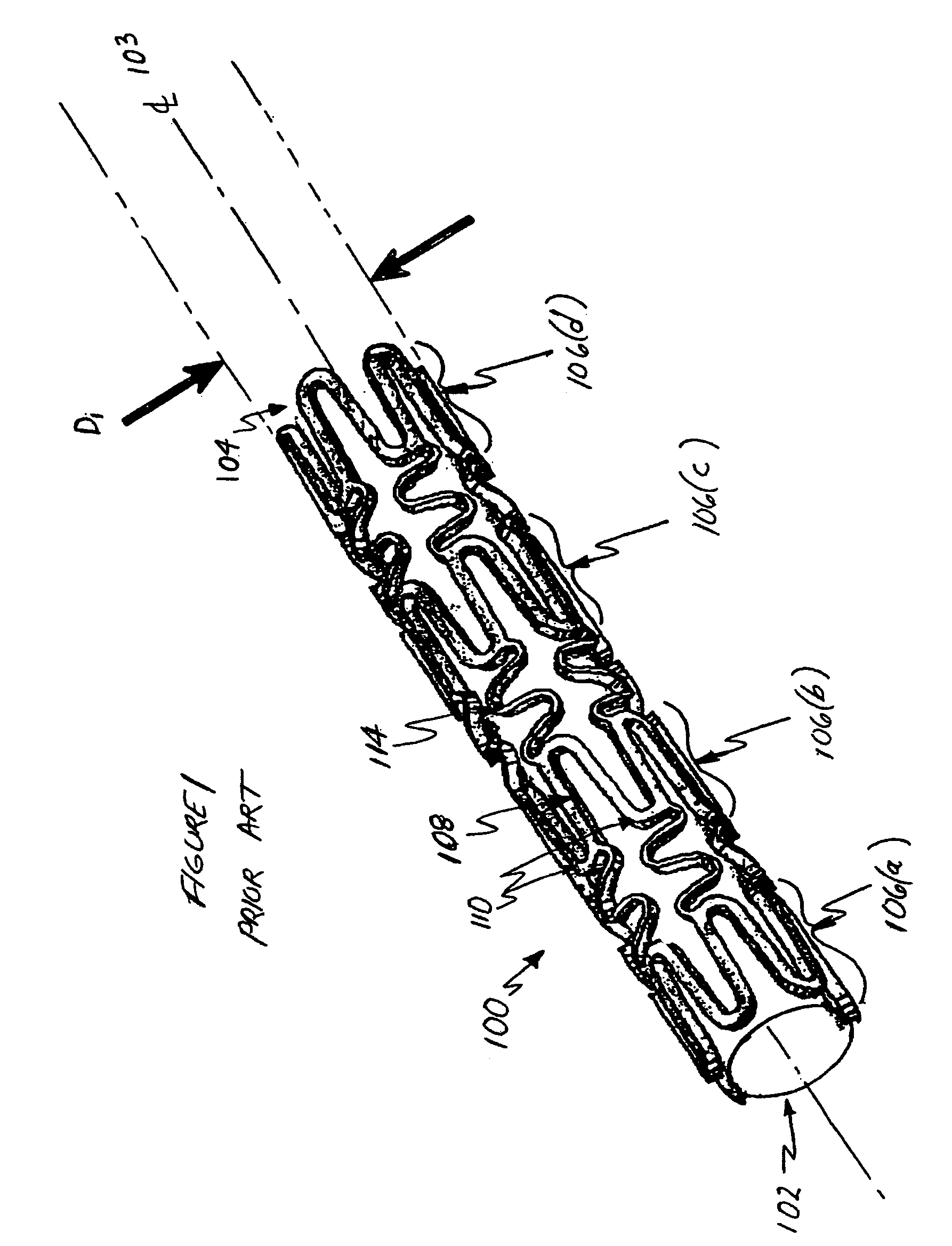 Stent having phased hoop sections