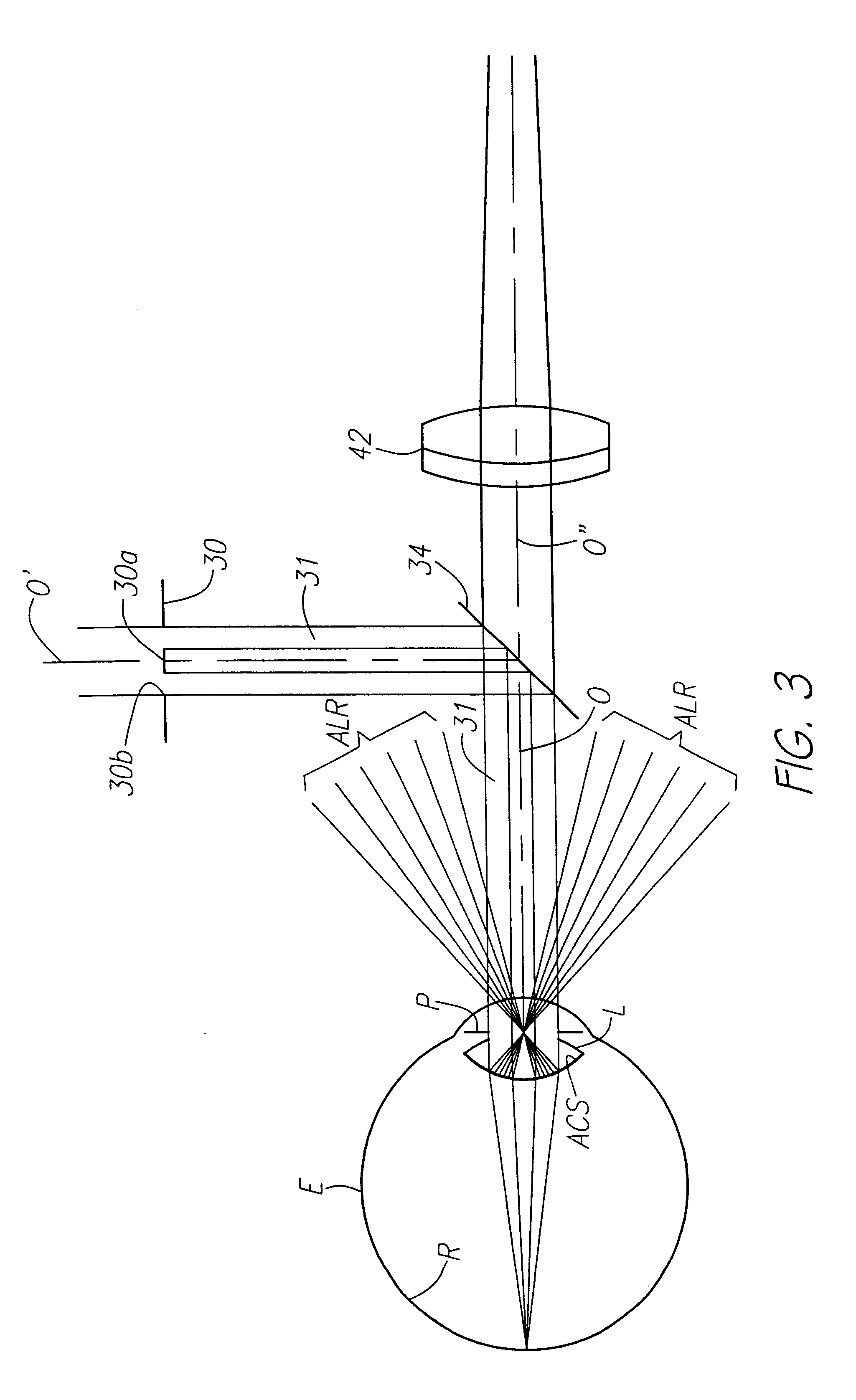 Method and apparatus for measuring optical aberrations of the human eye