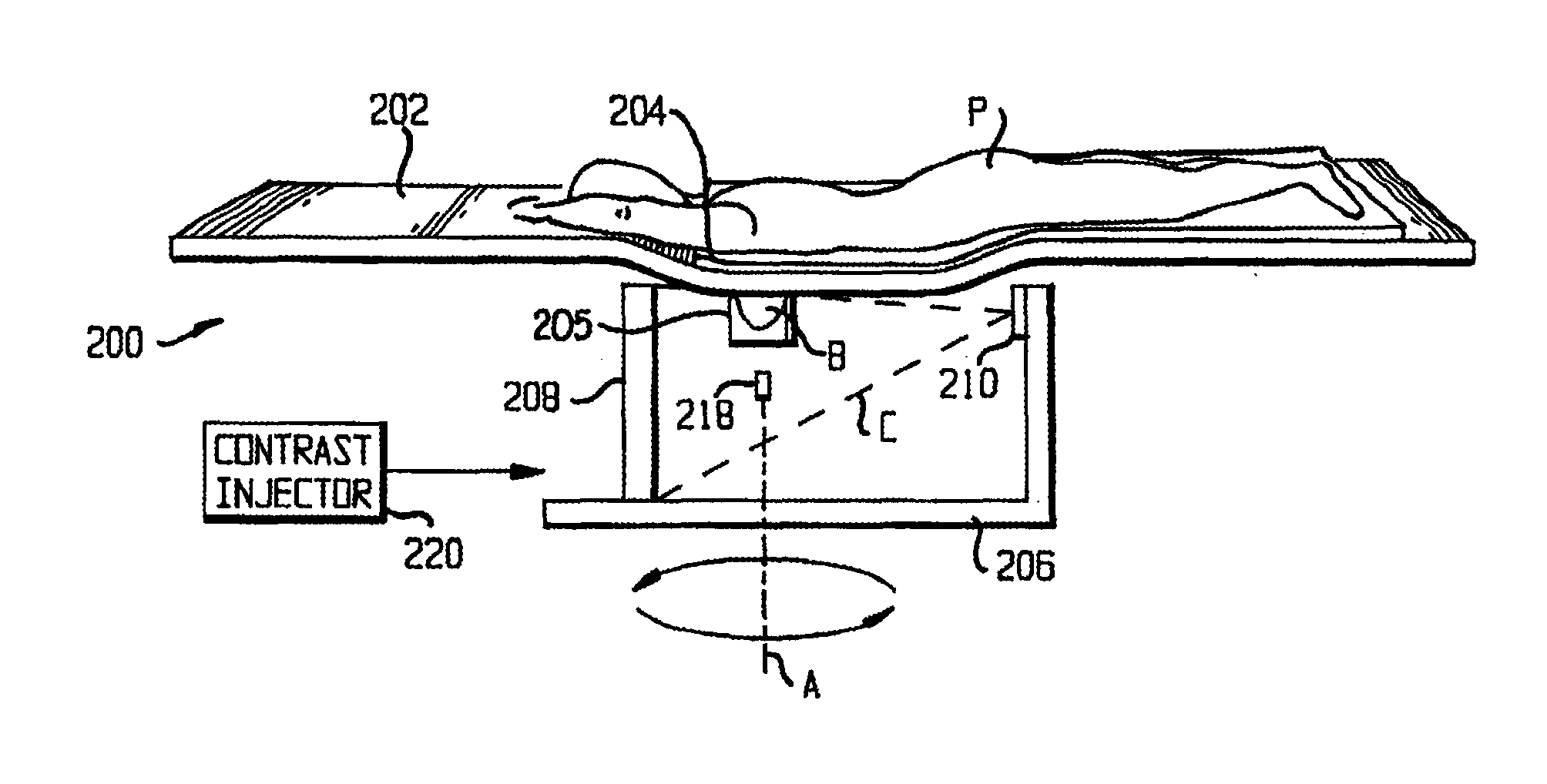 Method and apparatus for cone beam breast ct image-based computer-aided detection and diagnosis