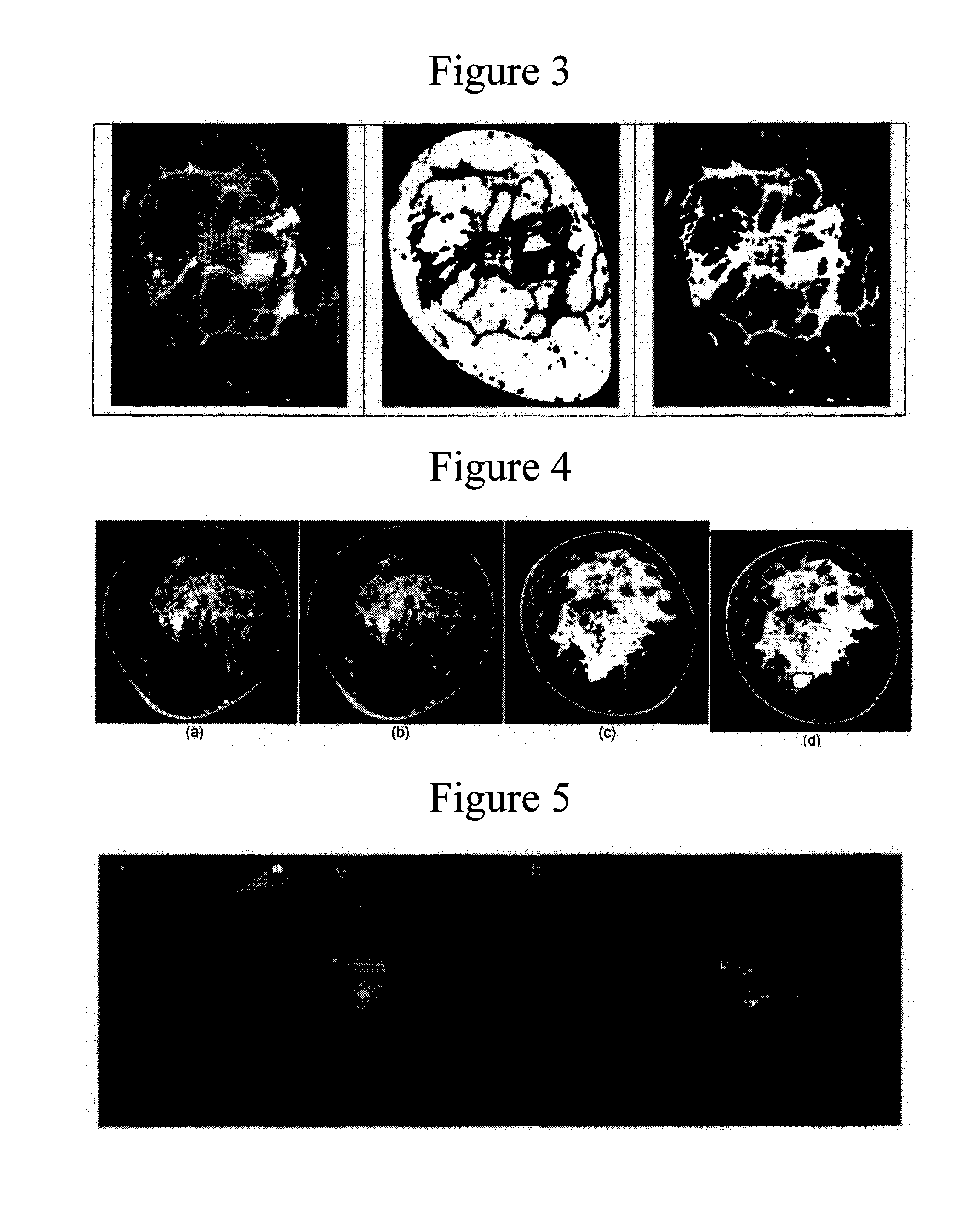 Method and apparatus for cone beam breast ct image-based computer-aided detection and diagnosis