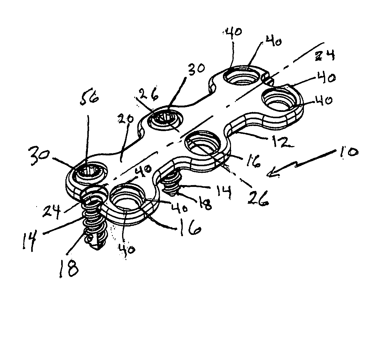 Anterior vertebral plate with quick lock screw