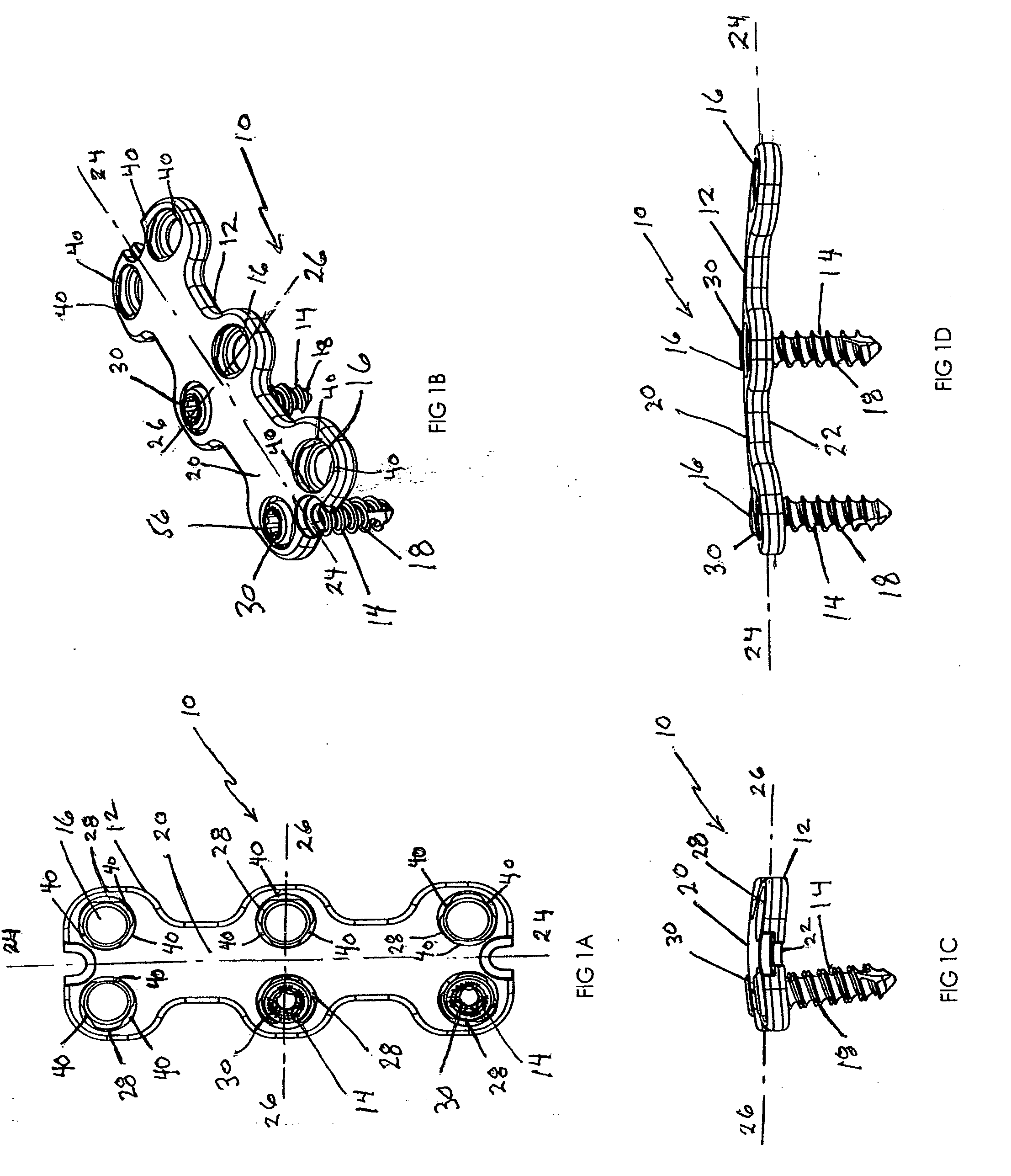 Anterior vertebral plate with quick lock screw