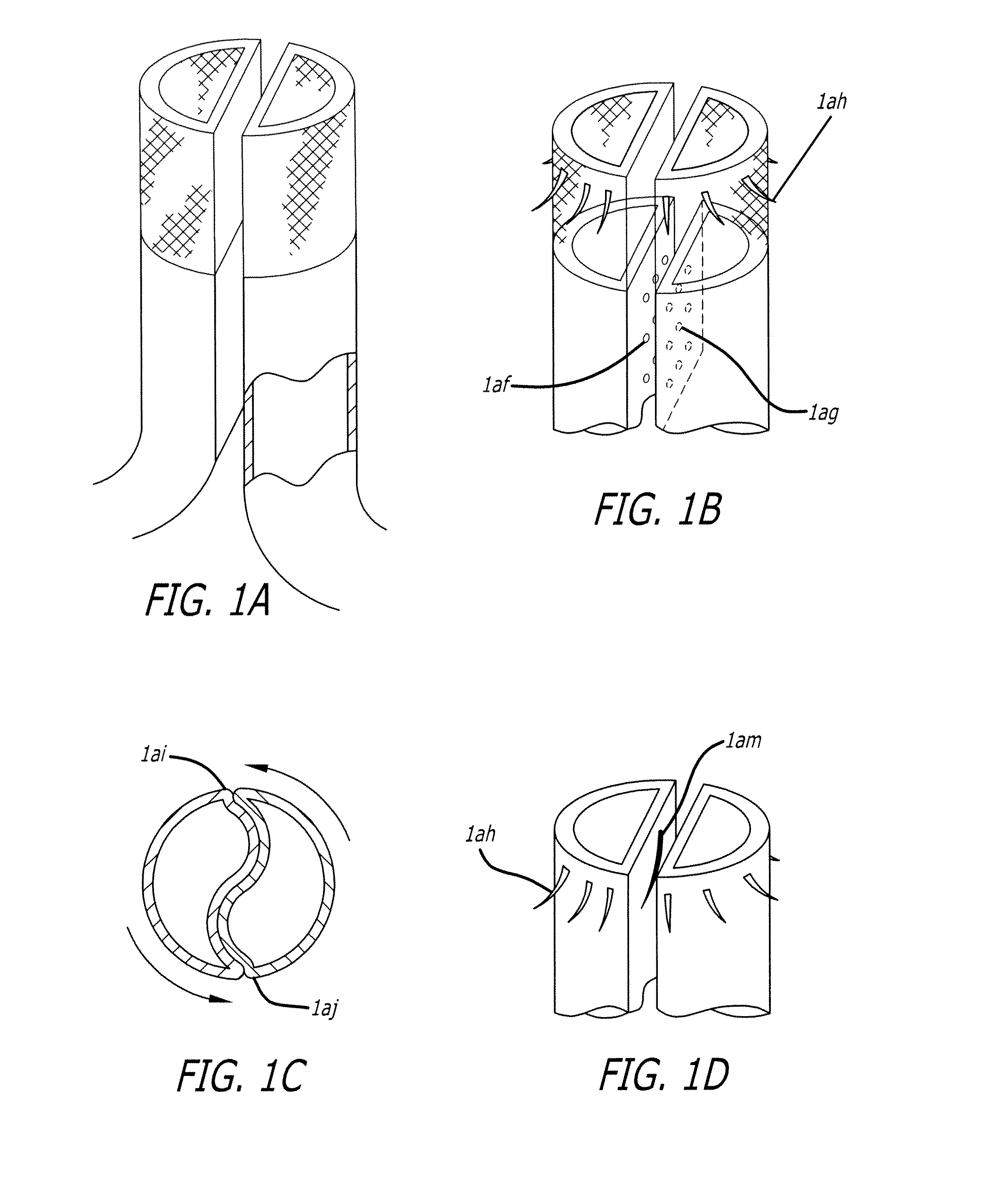 Low-profile modular abdominal aortic aneurysm graft