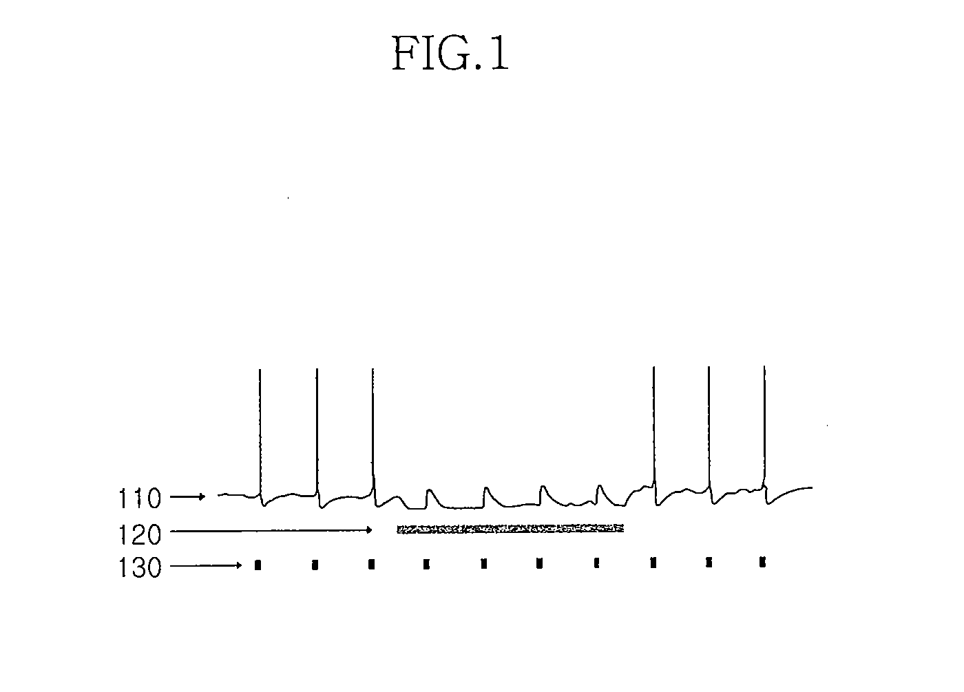 Apparatus for stimulating the brain and measuring the light induced neuronal activity and method for manufacturing the same