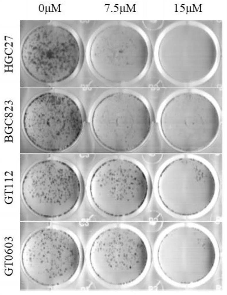 A new tumor stem cell killer for gastric cancer and its application