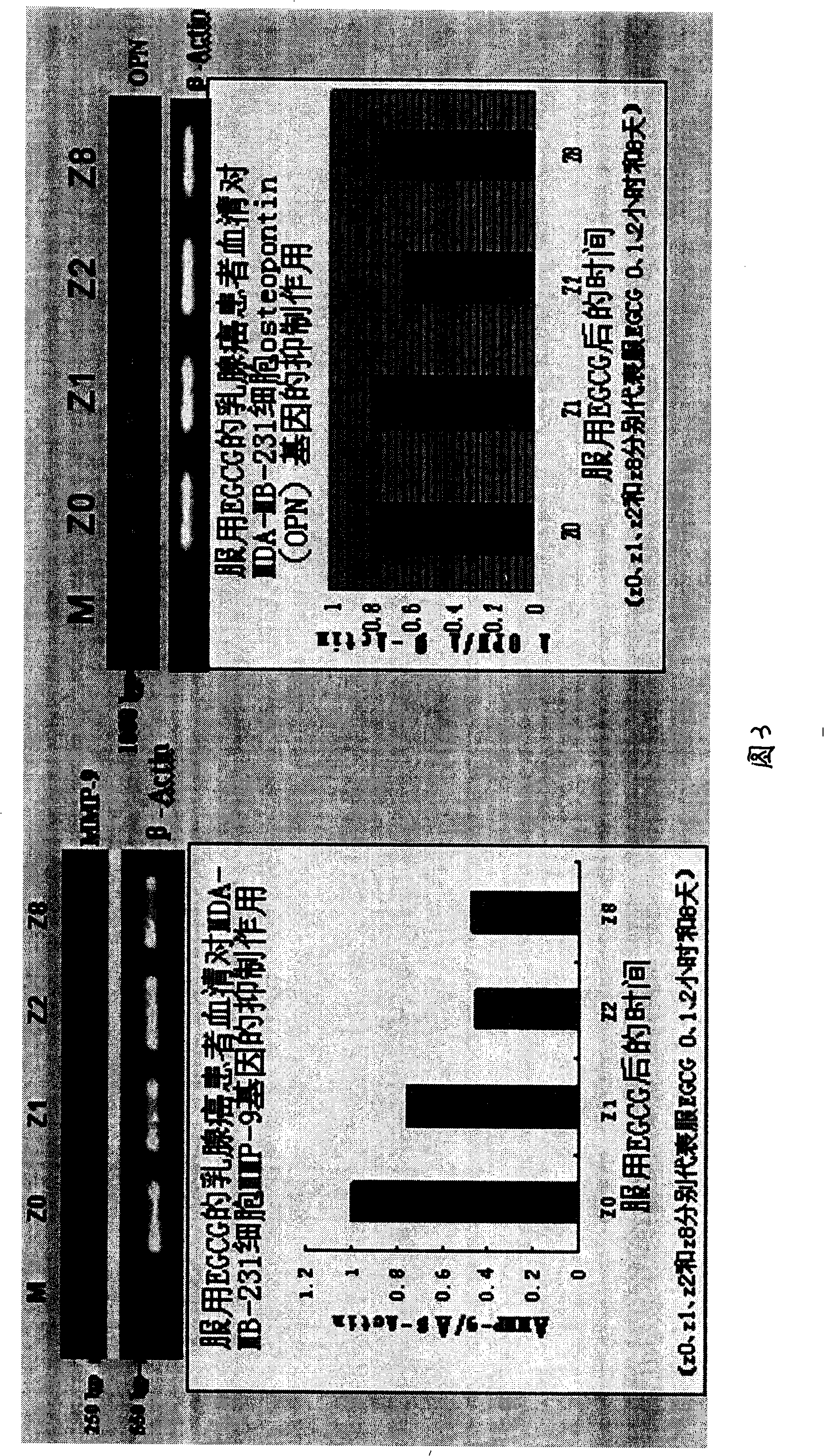 Application of epigallocatechin gallate in preparing product for preventing and treating human mammary cancer disease