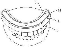 Double-layer resin tooth for oral tooth preparation training