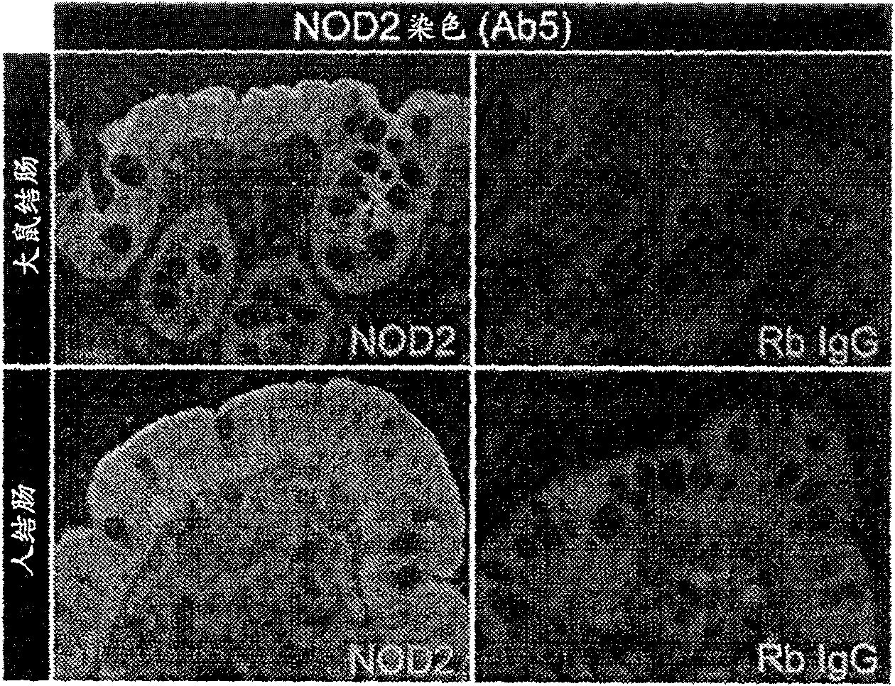 Anti-bacterial compositions