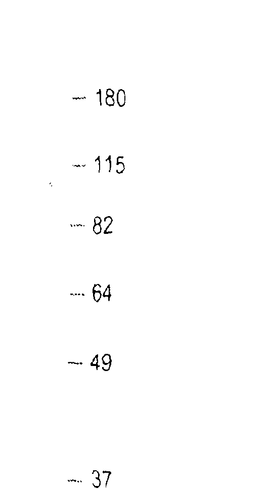 Anti-bacterial compositions