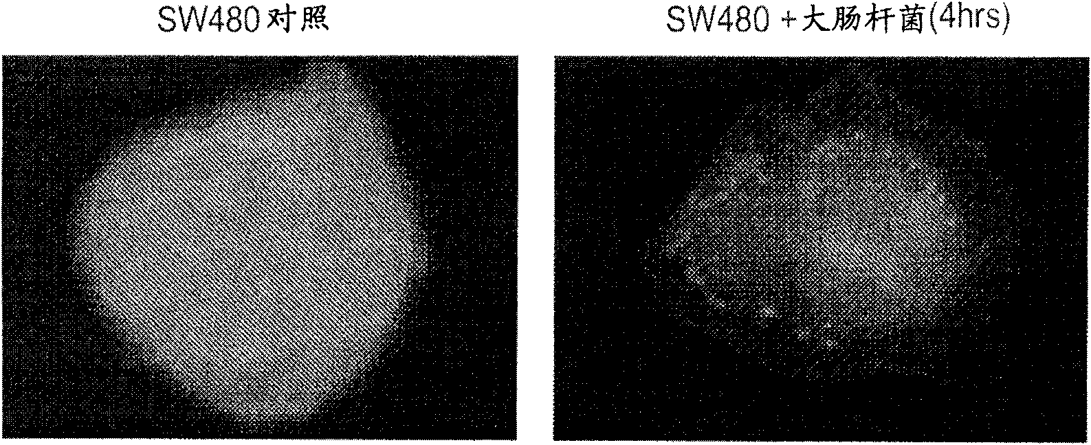 Anti-bacterial compositions