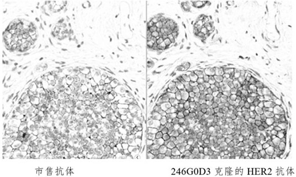 Anti-HER2 recombinant rabbit monoclonal antibody and application thereof