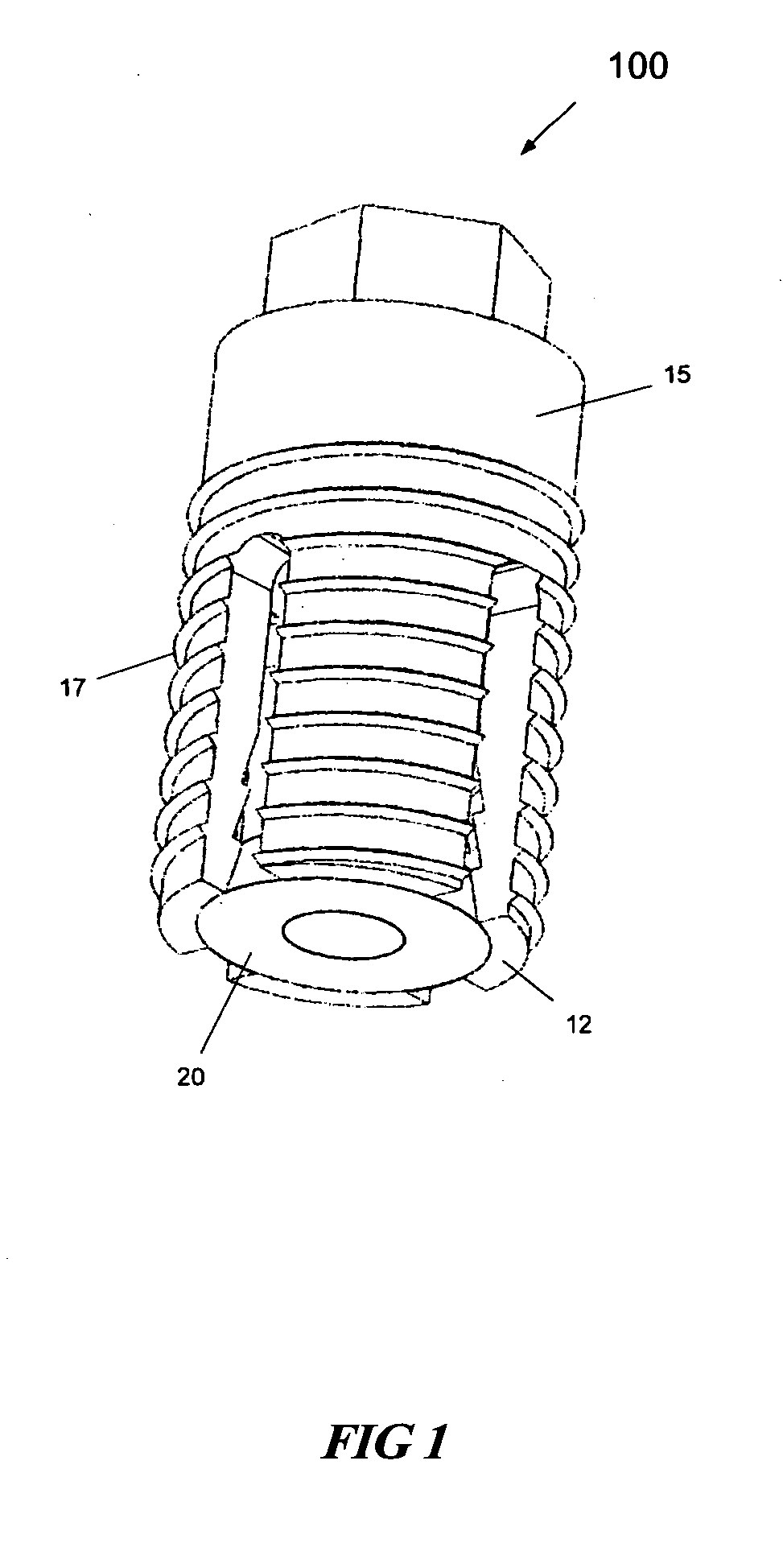 Expandable dental implants of high surface area and methods of expanding the same