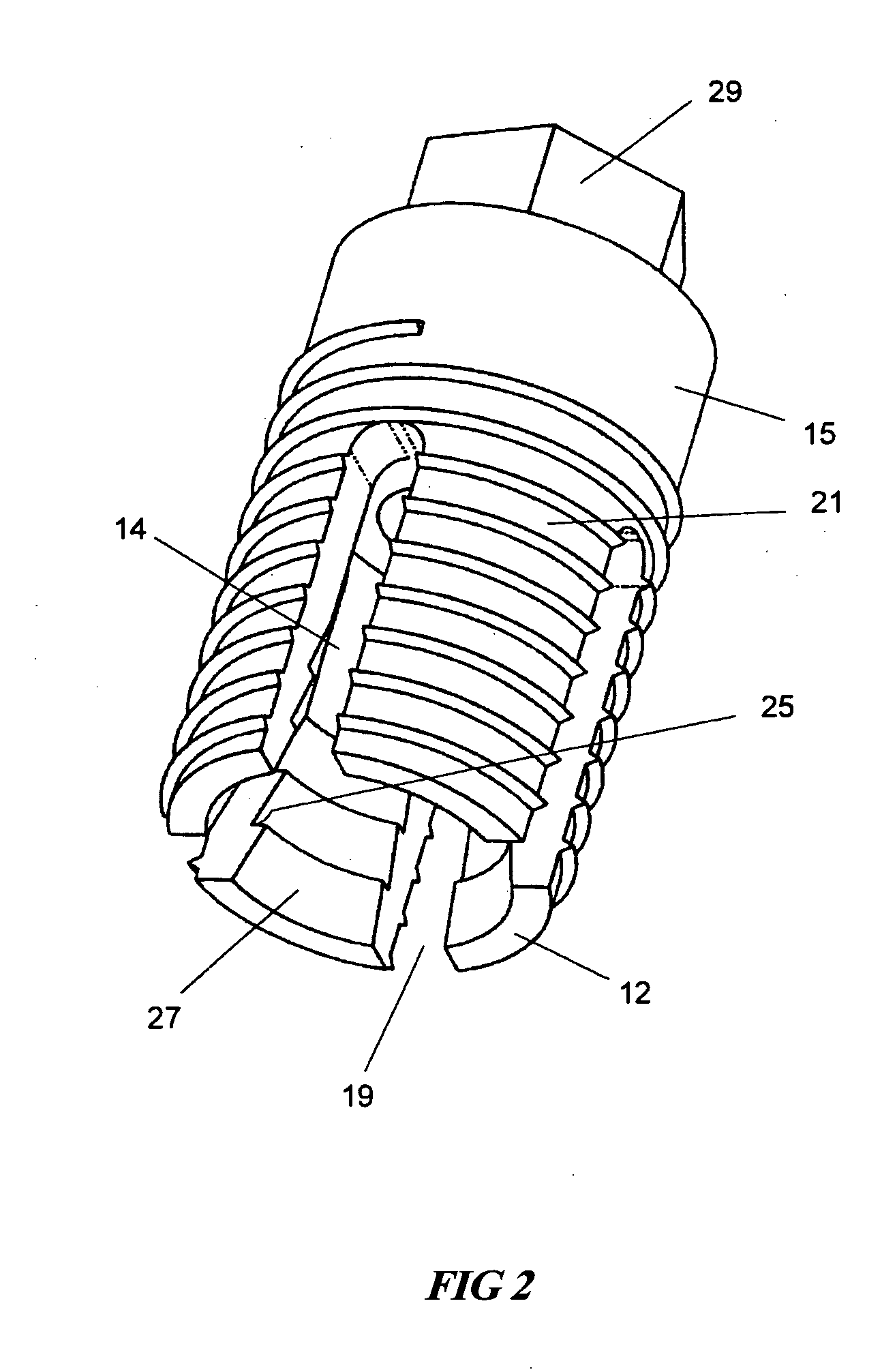 Expandable dental implants of high surface area and methods of expanding the same