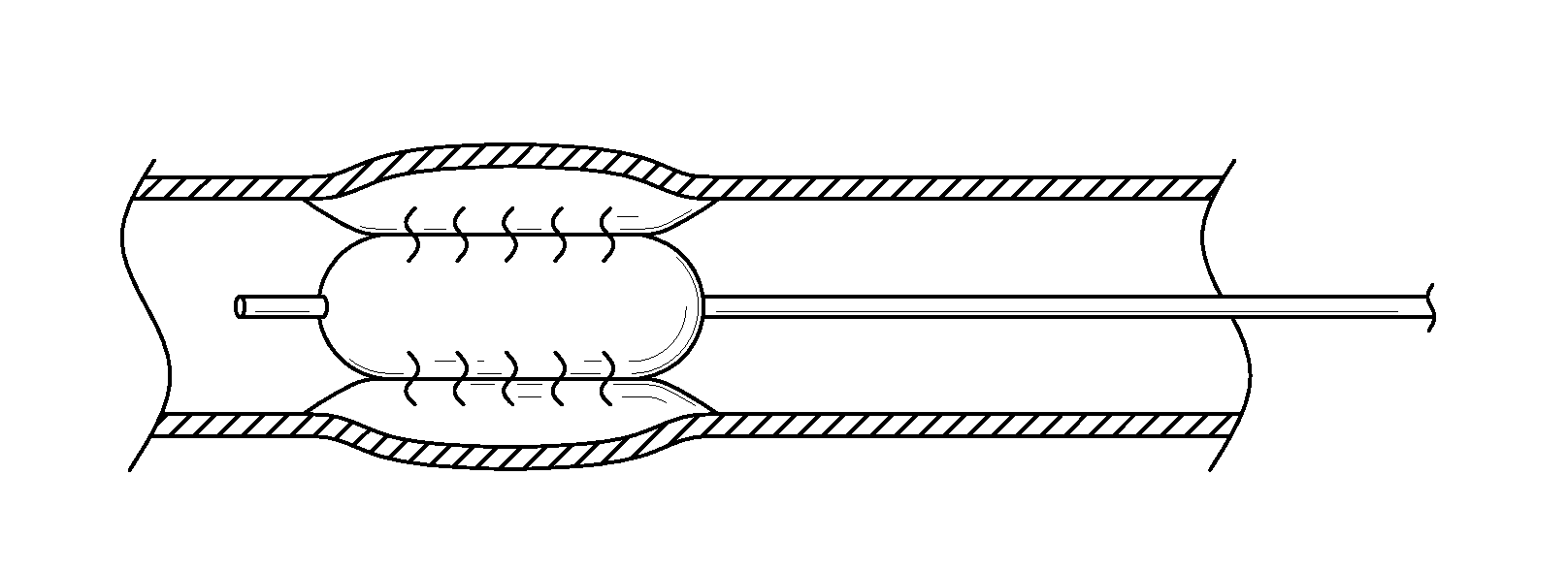 Controlled porosity devices for tissue treatments, methods of use, and methods of manufacture