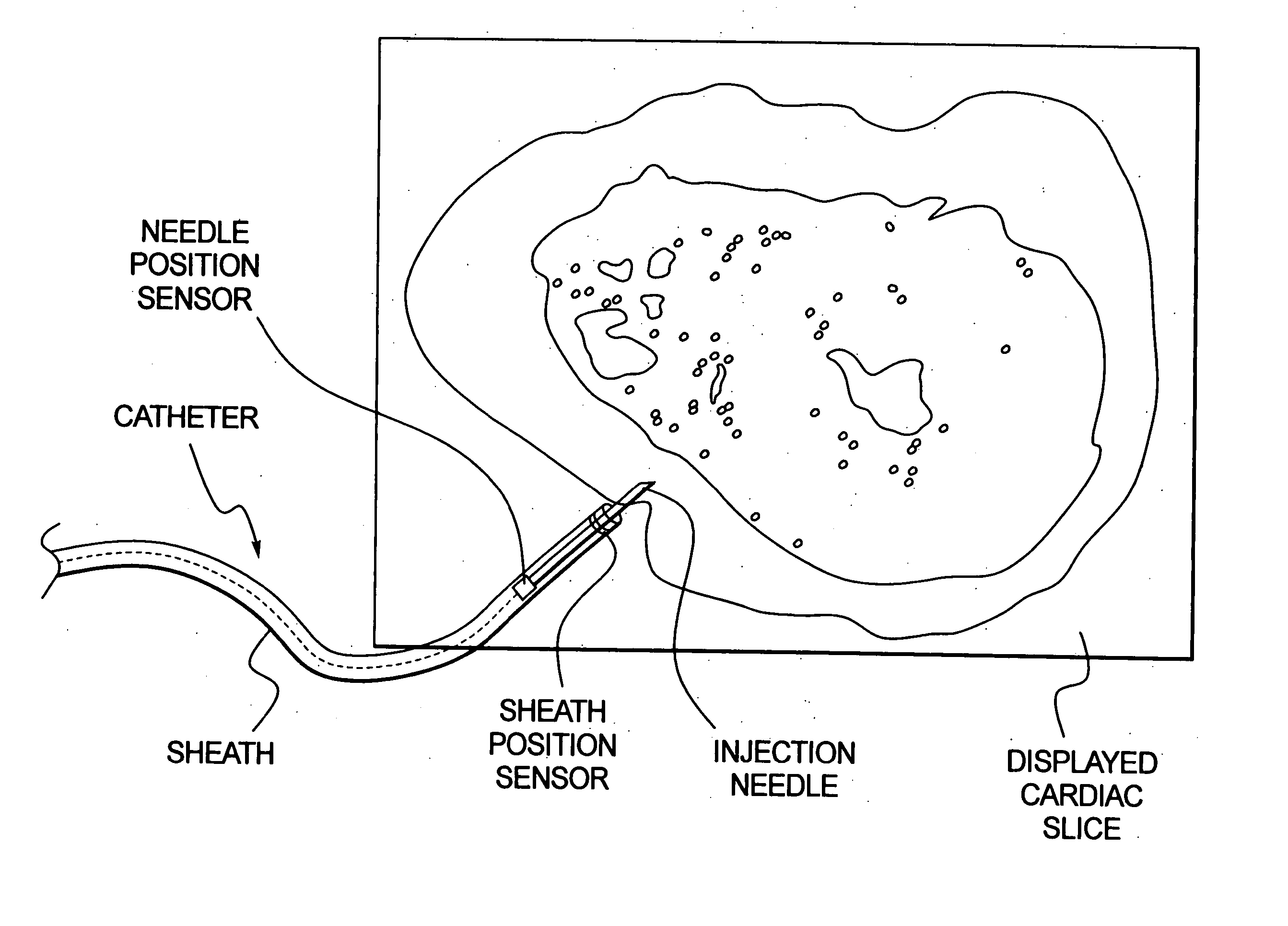 Method for accurate in vivo delivery of a therapeutic agent to a target area of an organ