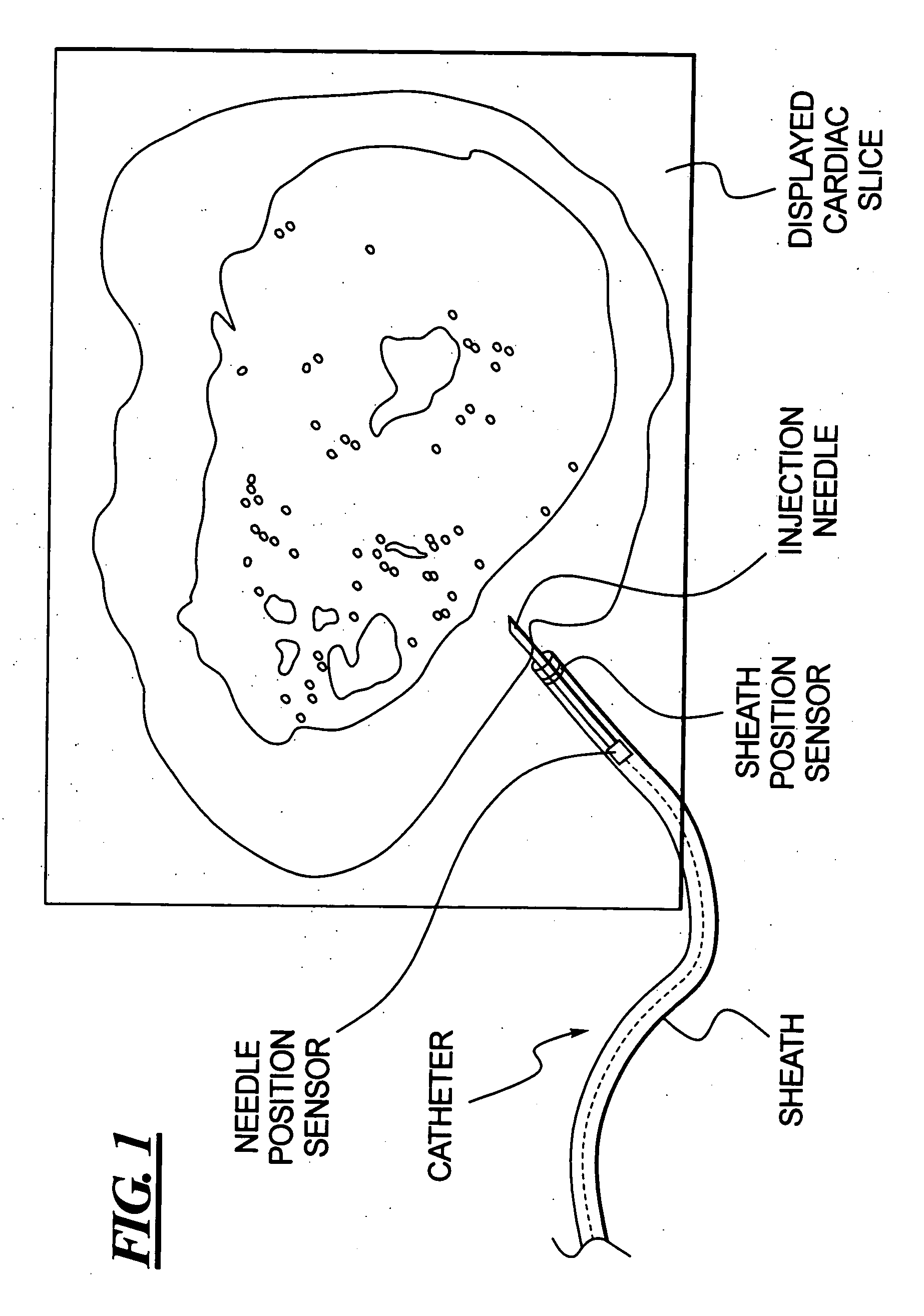 Method for accurate in vivo delivery of a therapeutic agent to a target area of an organ