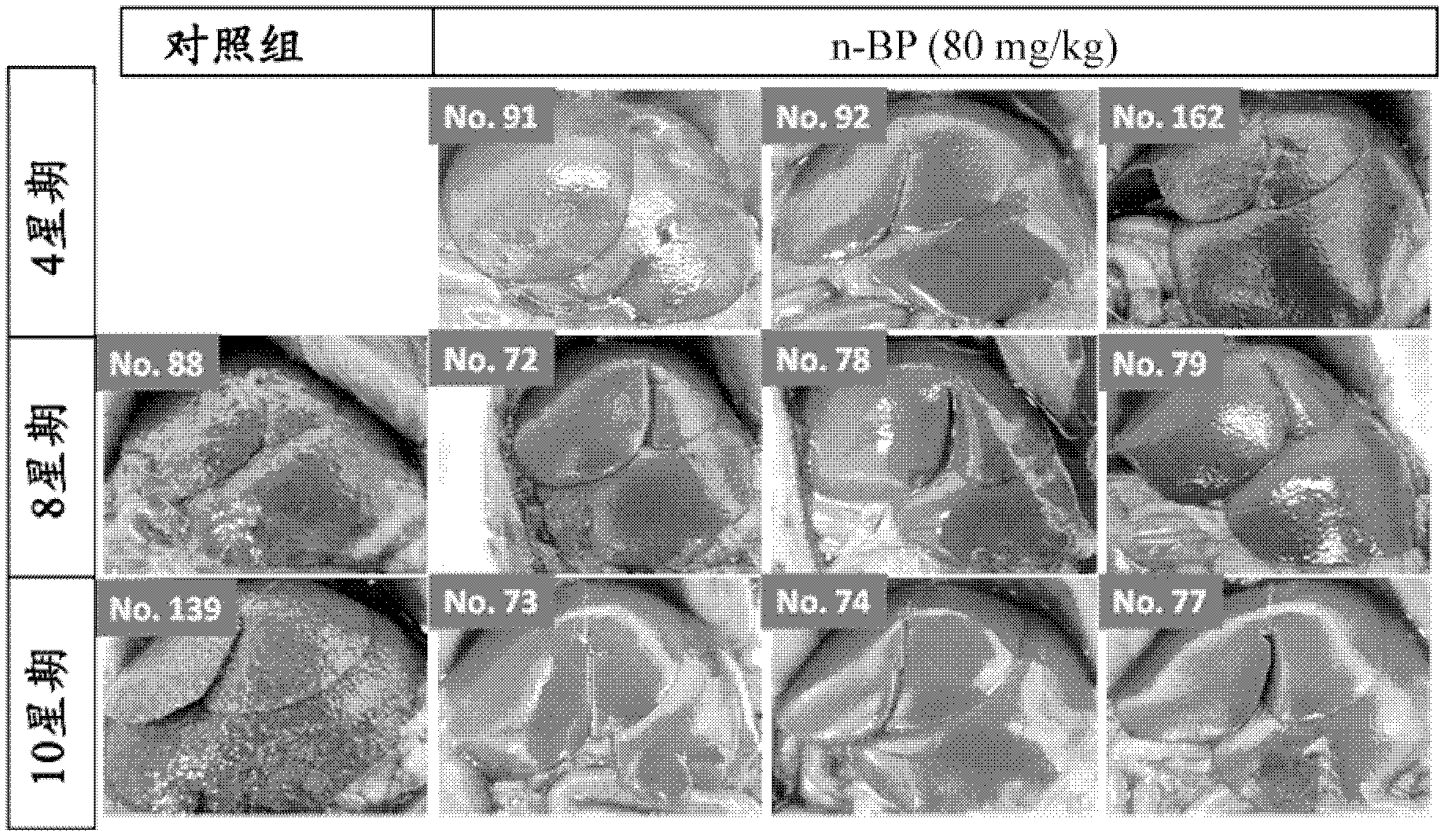 Use of n-Butylidenephthalide for making medicines treating liver injuries and improving liver functions and medical composition