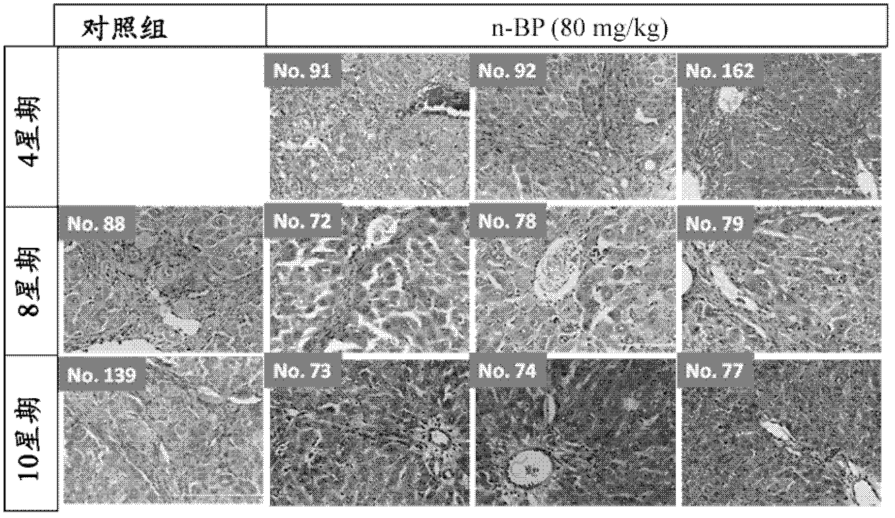 Use of n-Butylidenephthalide for making medicines treating liver injuries and improving liver functions and medical composition