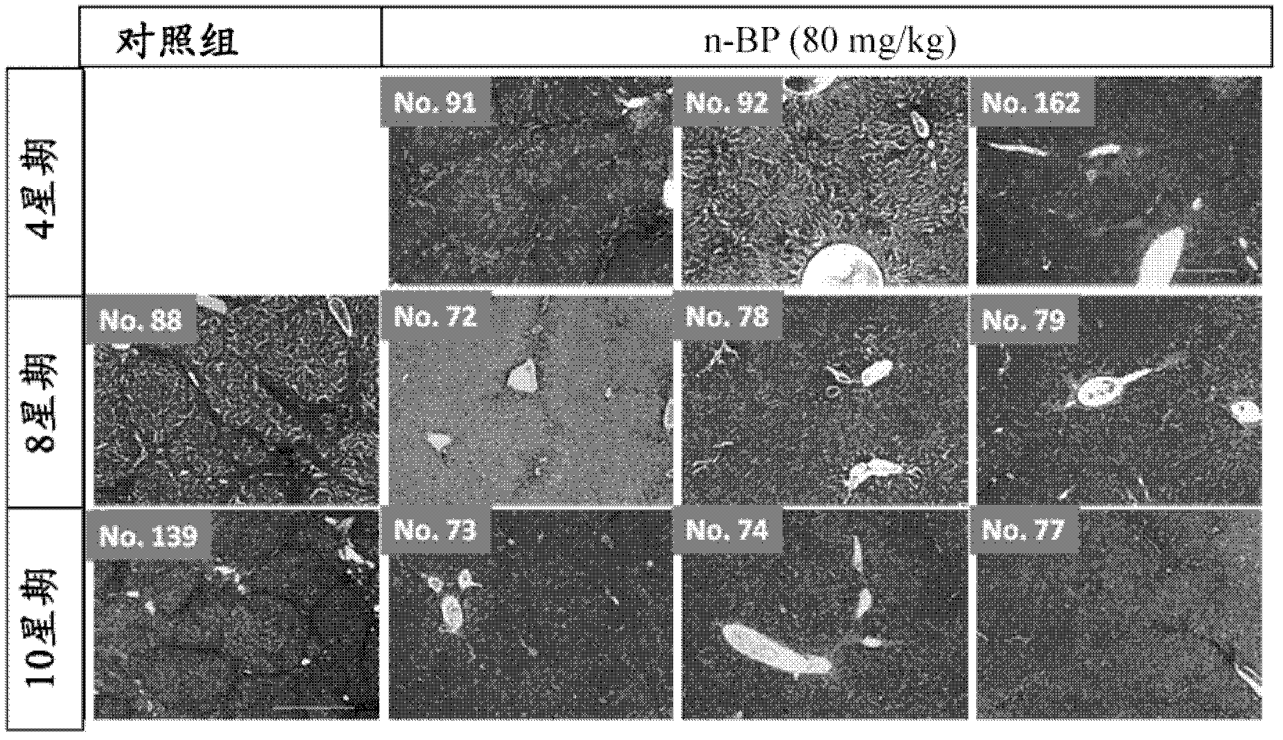 Use of n-Butylidenephthalide for making medicines treating liver injuries and improving liver functions and medical composition