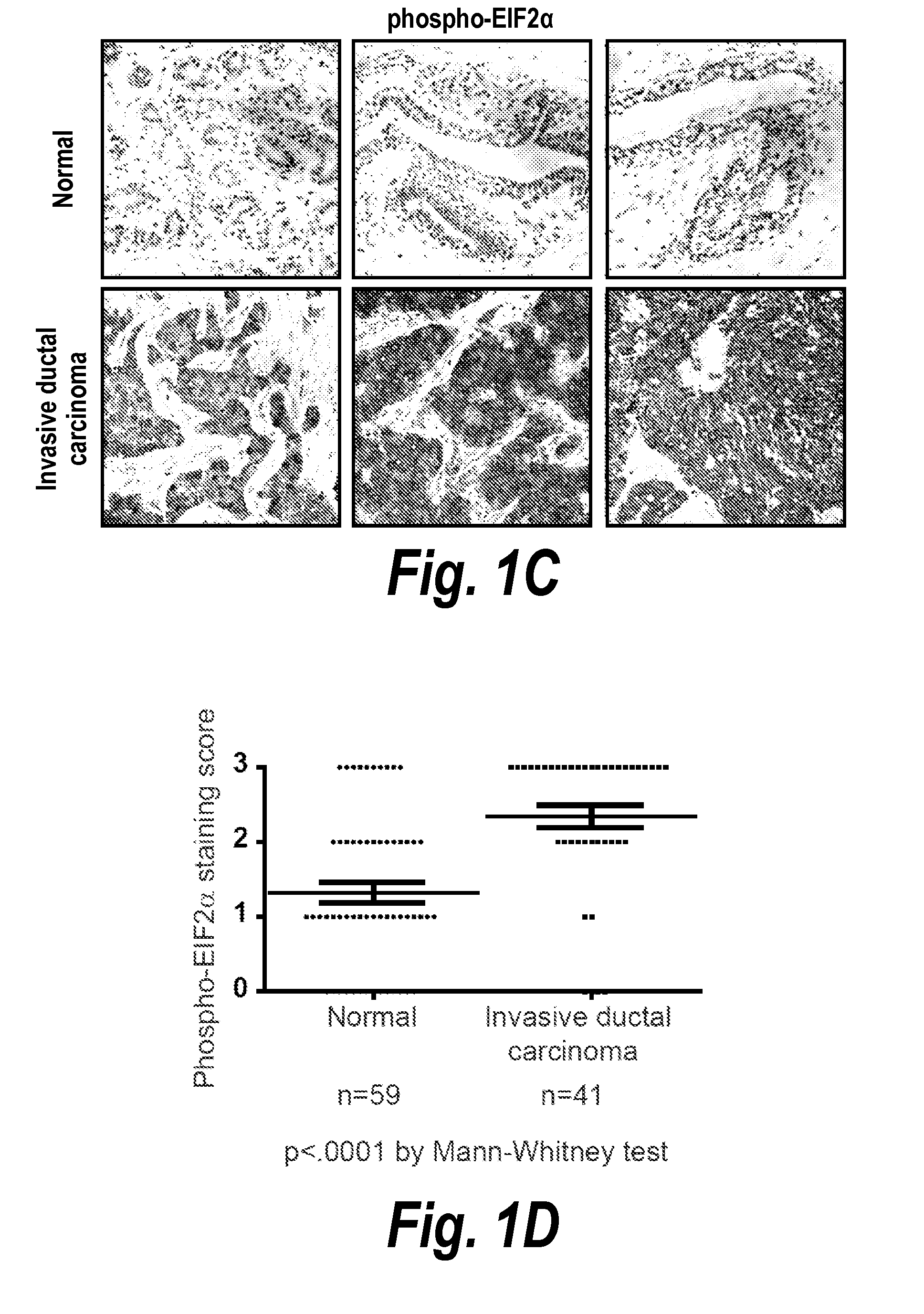 Modulation of breast cancer growth by modulation of xbp1 activity