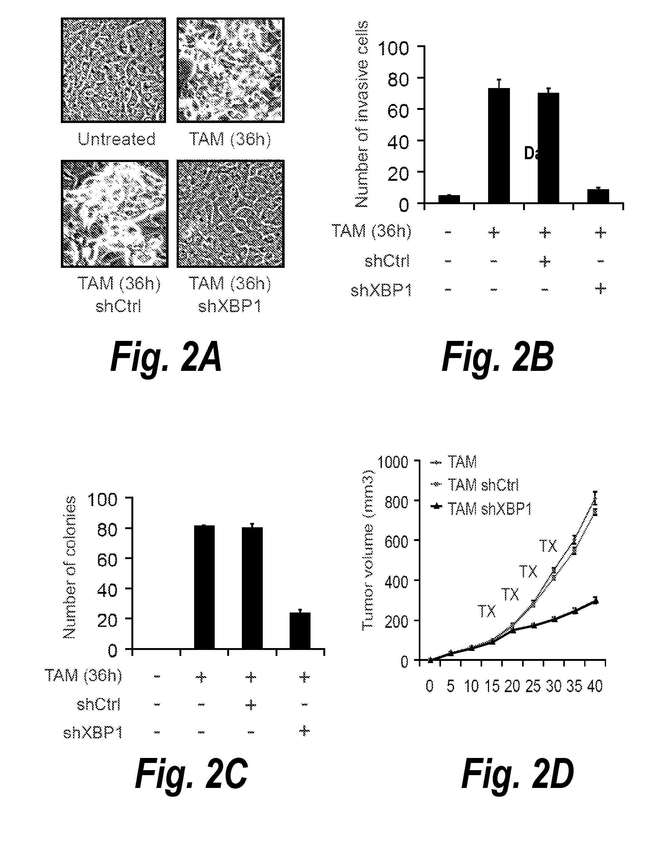 Modulation of breast cancer growth by modulation of xbp1 activity