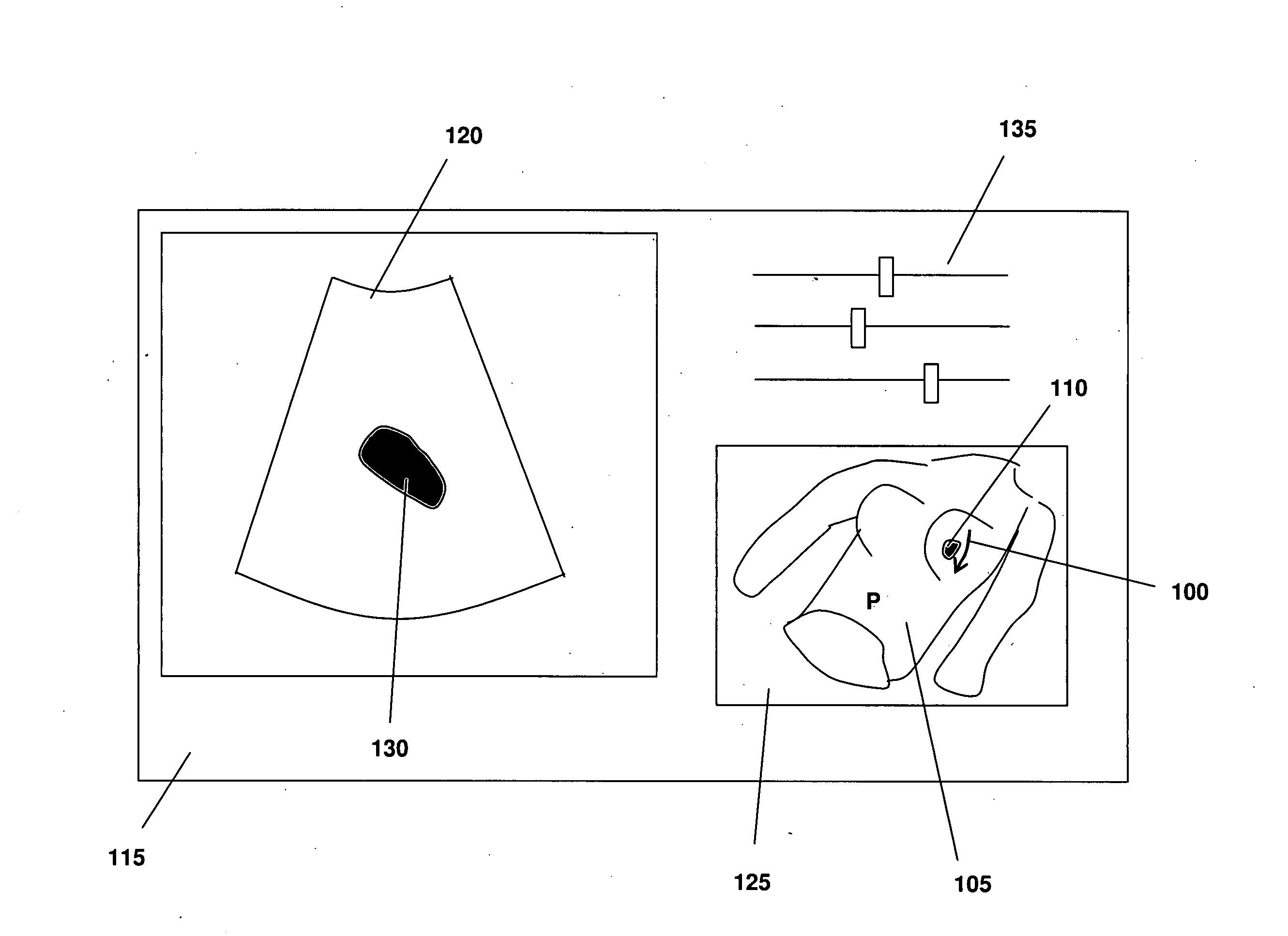 Methods and systems for guiding the acquisition of ultrasound images