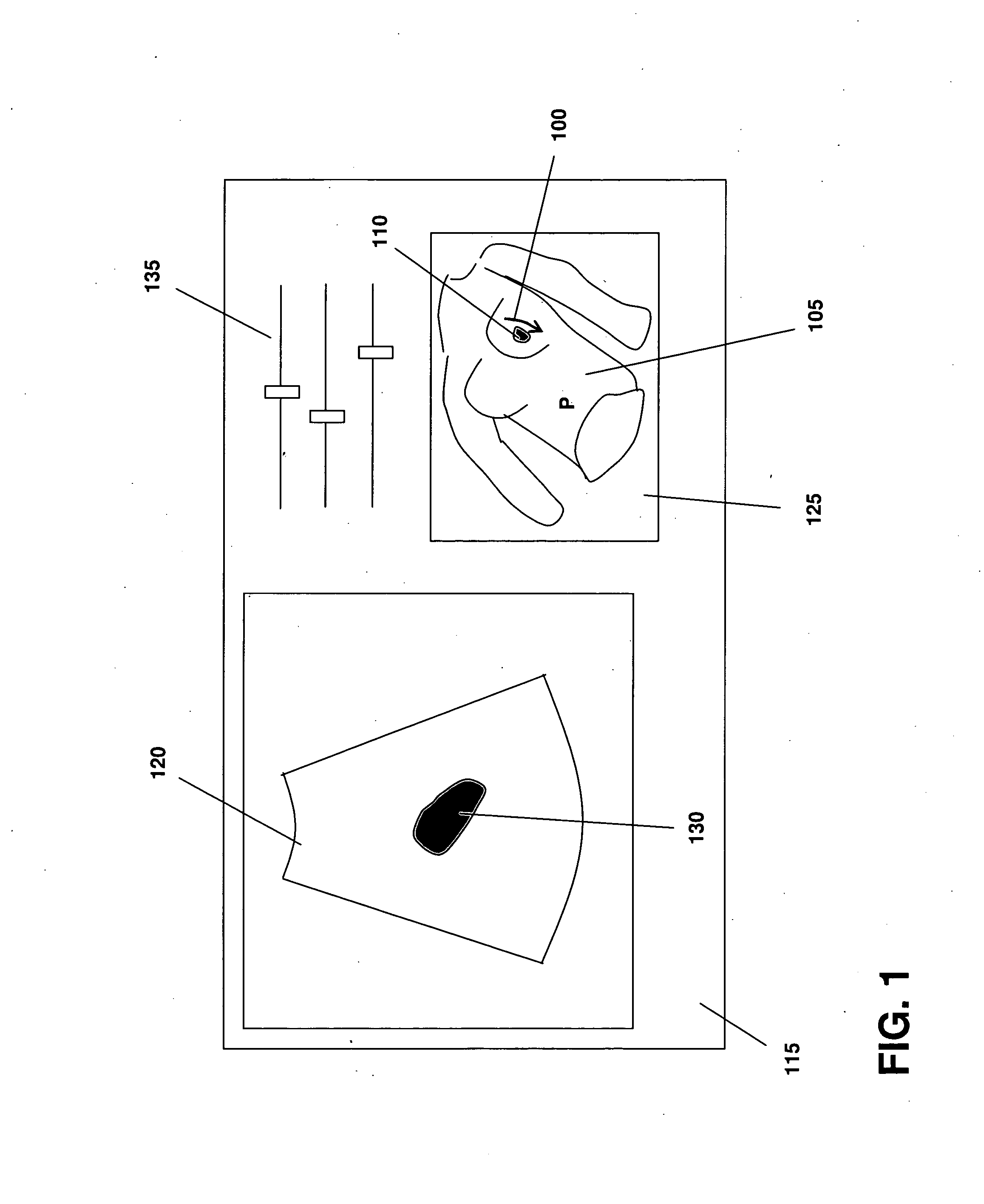 Methods and systems for guiding the acquisition of ultrasound images