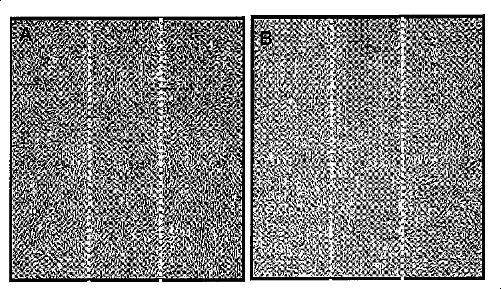 Application of butein in preparing the medicine for preventing the blood vessel from regenerating