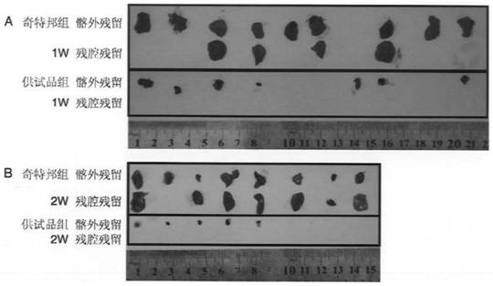 Preparation method and application of absorbable collagen sponge